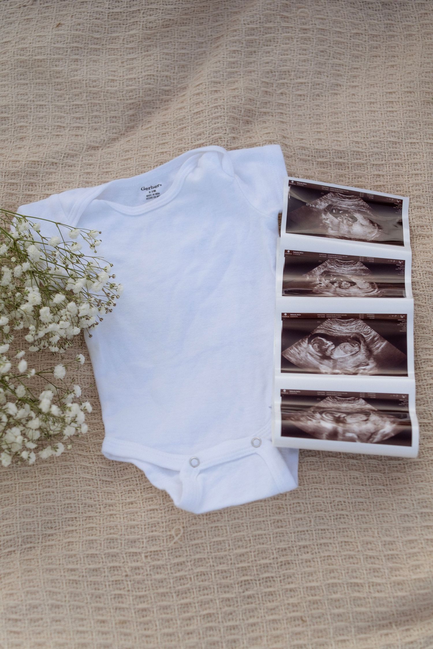 White baby onesie and ultrasound photos arranged with baby's breath flowers on a neutral textured background.
