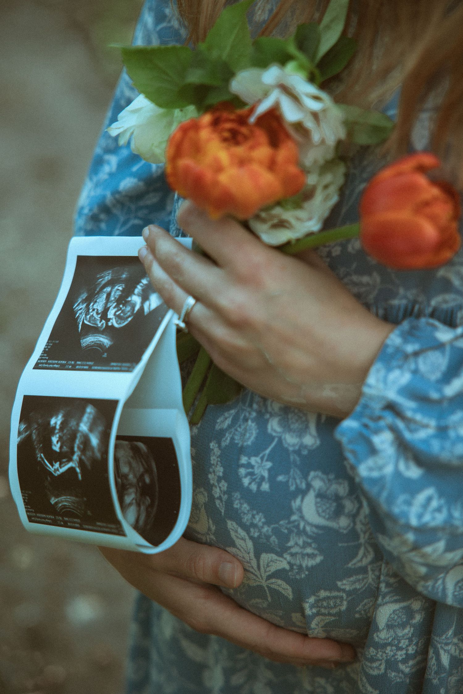 Pregnant woman in a blue floral dress holds ultrasound photos and an orange tulip bouquet against her belly.