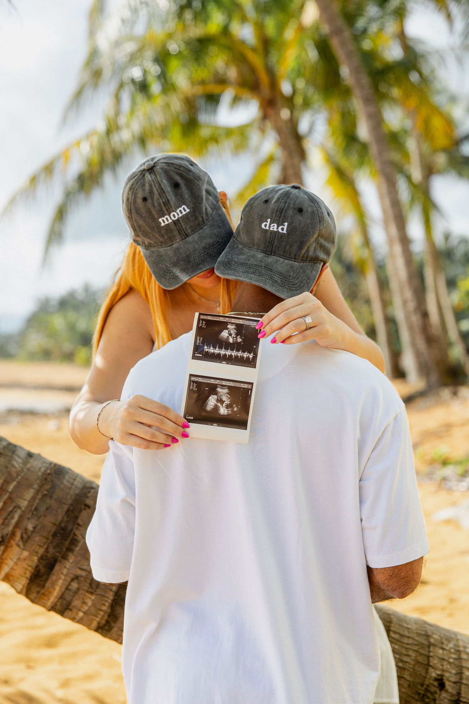 Couple wearing mom and dad hats holding ultrasound photo on tropical beach for pregnancy announcement.
