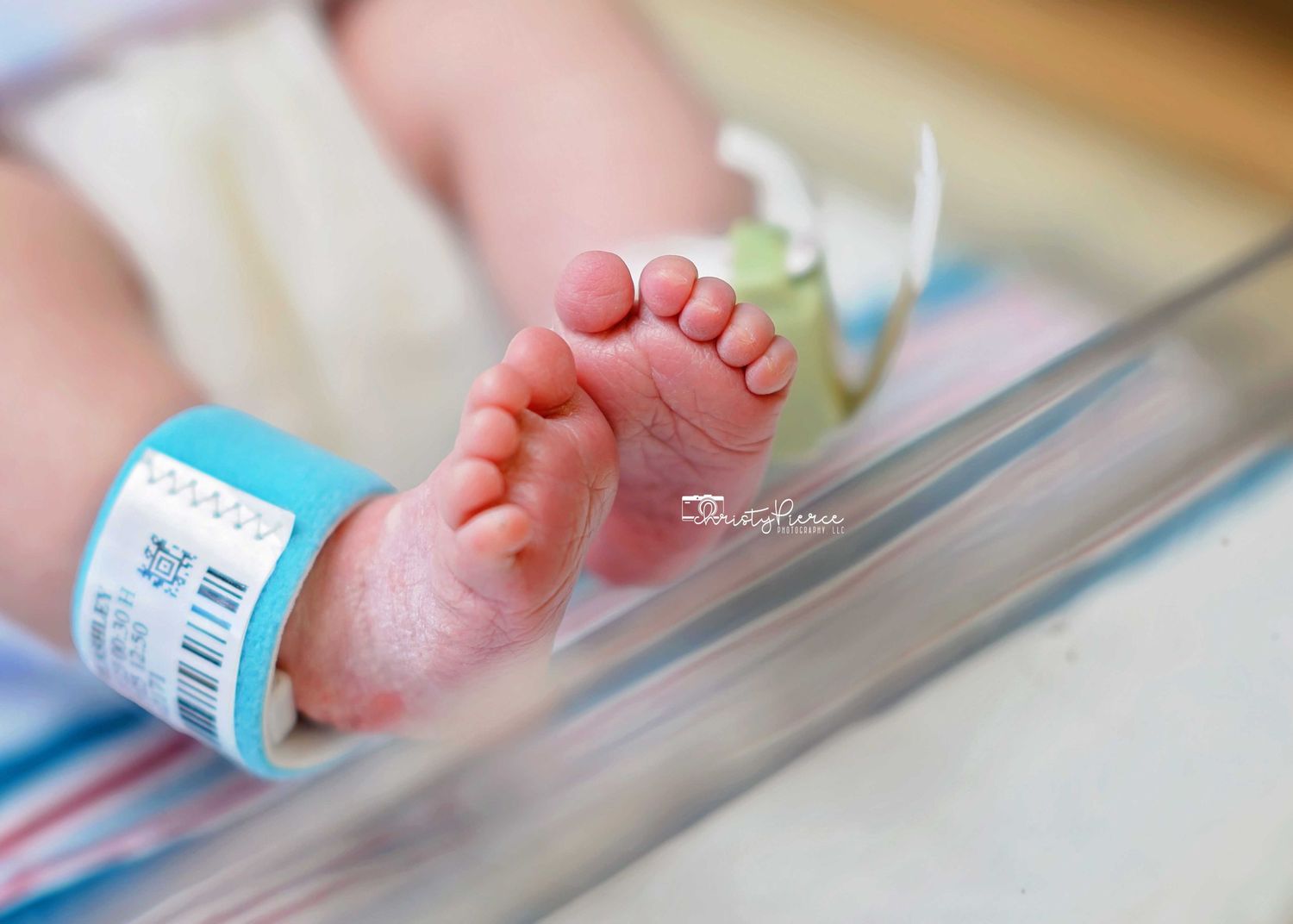 Close up of tiny newborn baby feet with hospital identification bands in a medical setting.