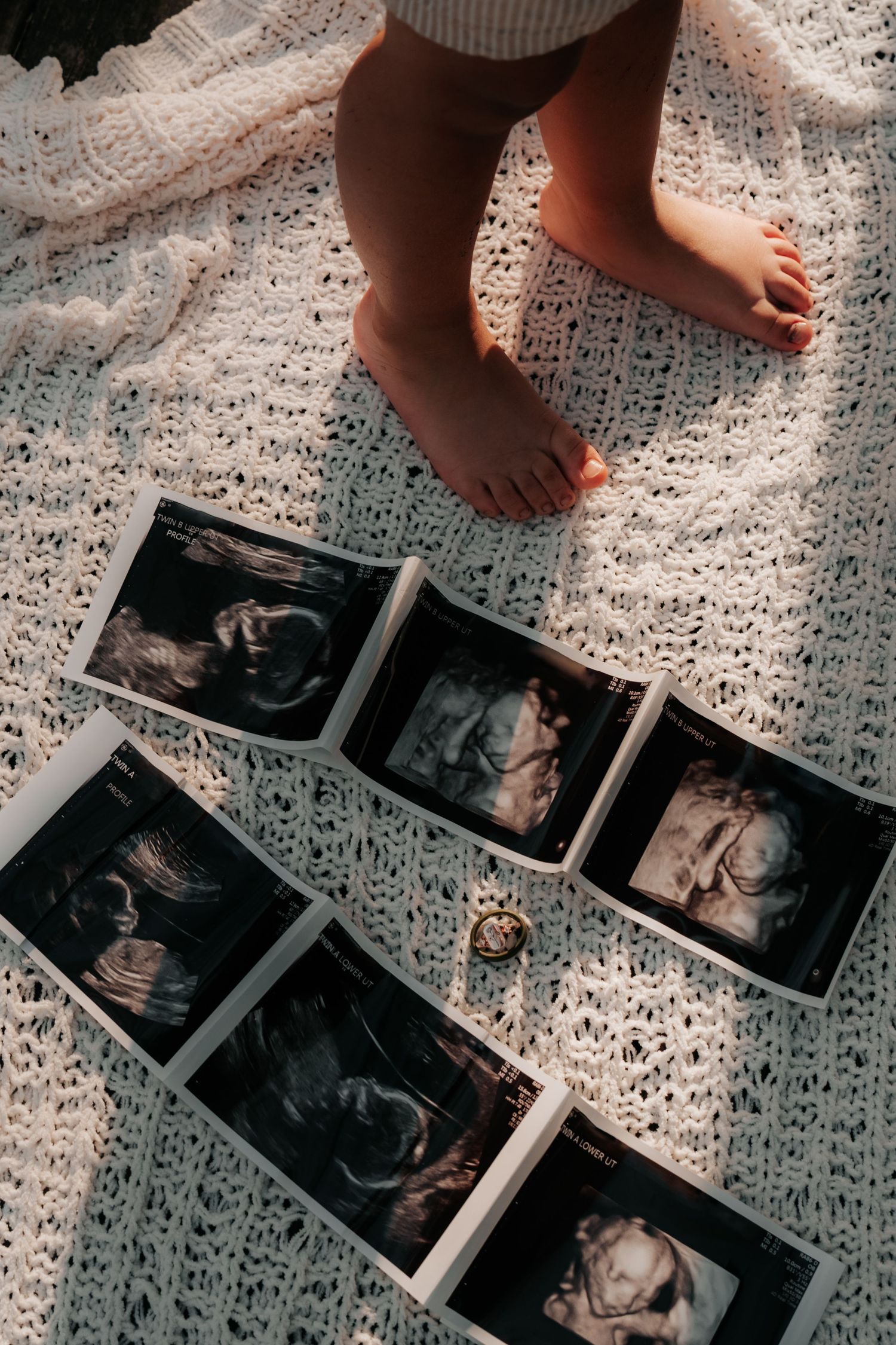 Small bare feet standing on white lace fabric next to arranged ultrasound sonogram photos laid out below.