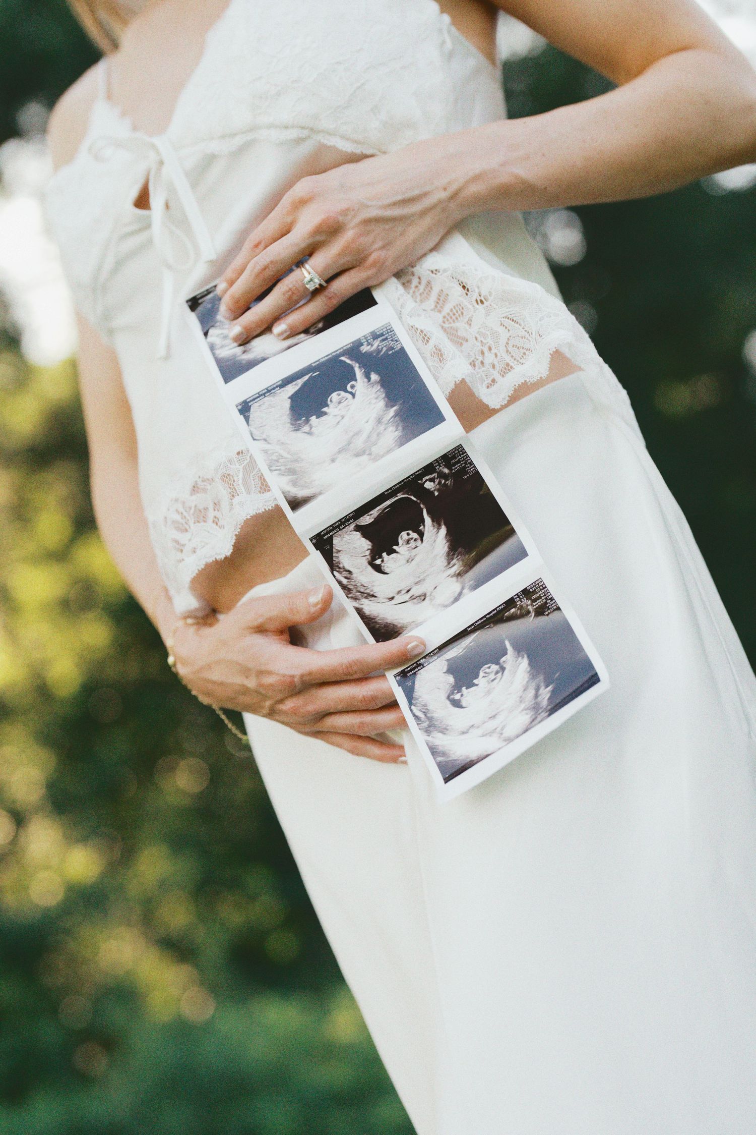 Pregnant woman in white lace dress holding ultrasound photos against her baby bump outdoors.
