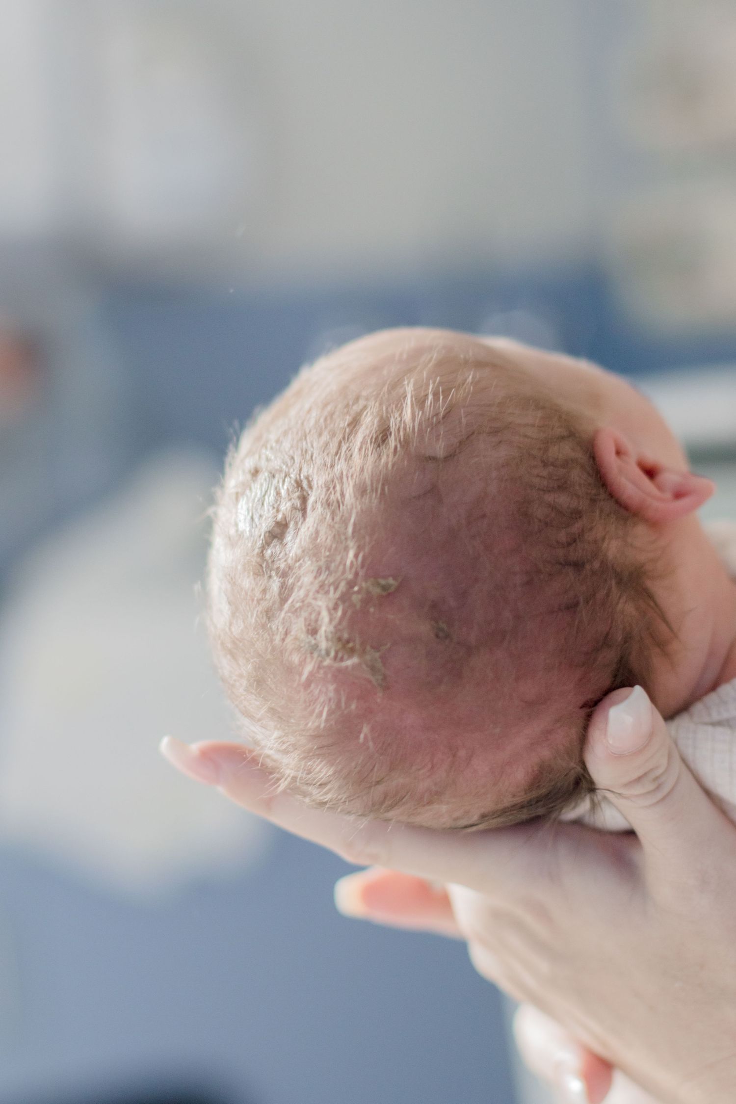 Close-up view of a newborn baby's head being gently supported by caregiver hands.