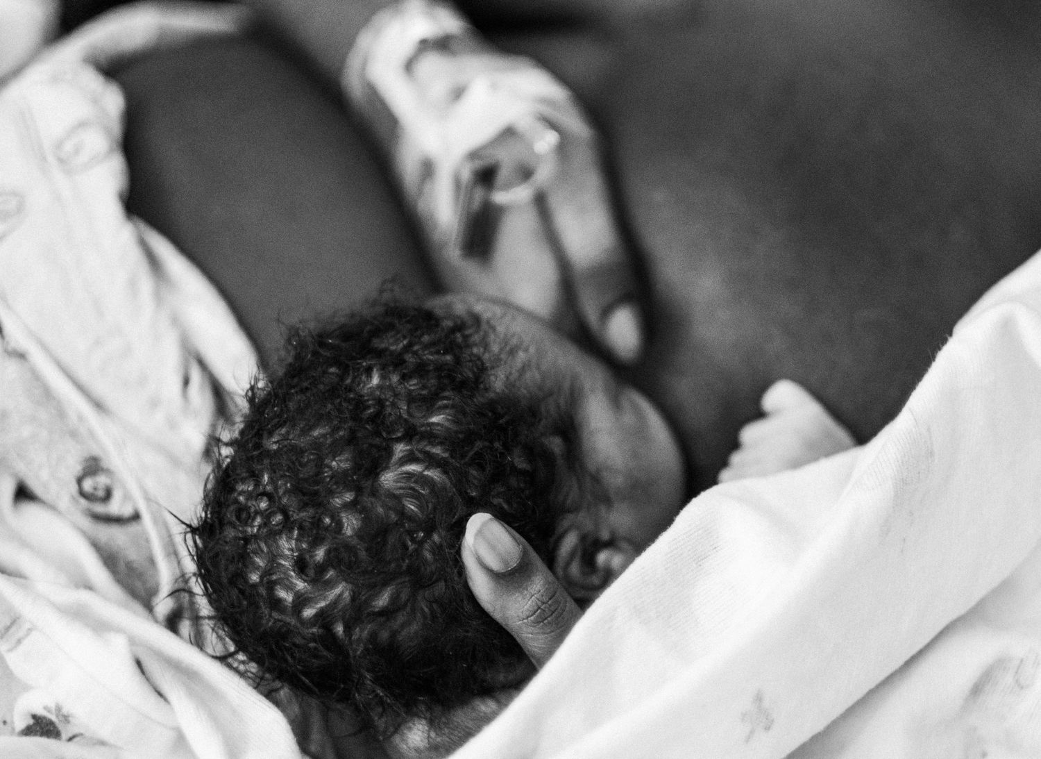 Close-up black and white image of a patient receiving medical treatment.