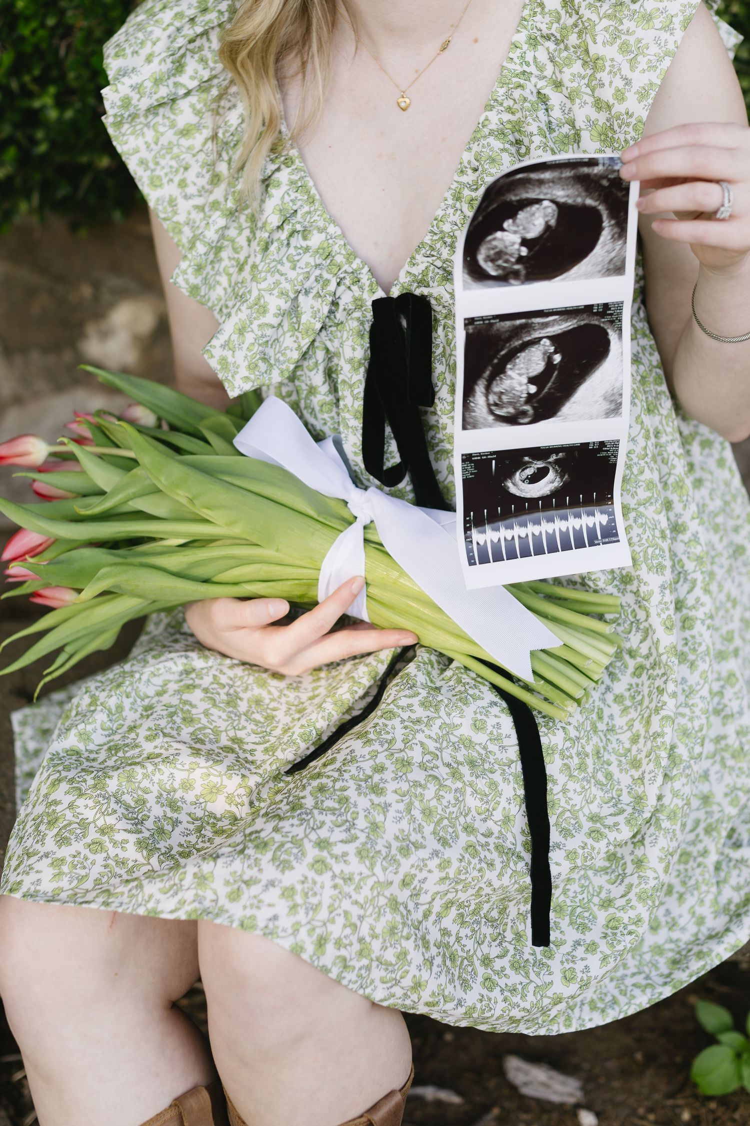 Someone in a floral dress holds tulips and ultrasound photos while sitting outdoors in a garden setting.