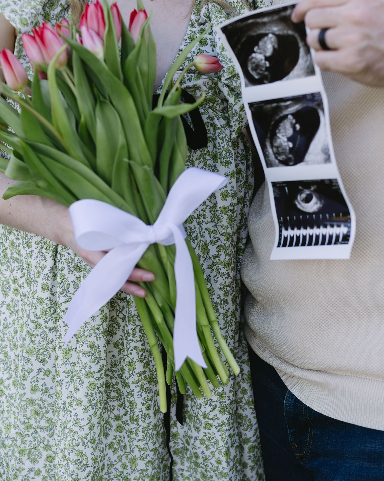 A bouquet of pink tulips with white ribbon next to ultrasound photos showcasing a pregnancy announcement.