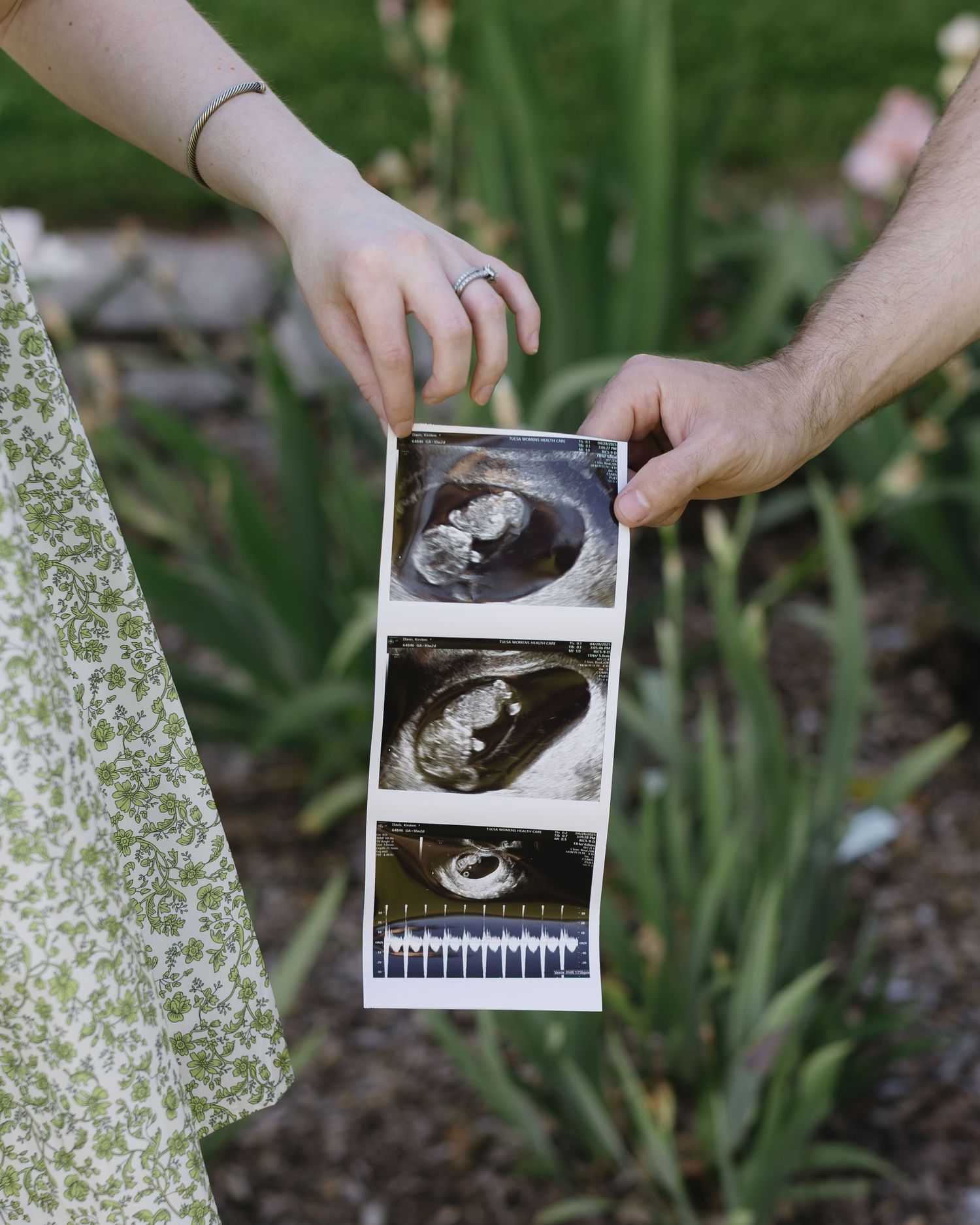 Close-up of hands holding black and white ultrasound photos against a background of garden plants.