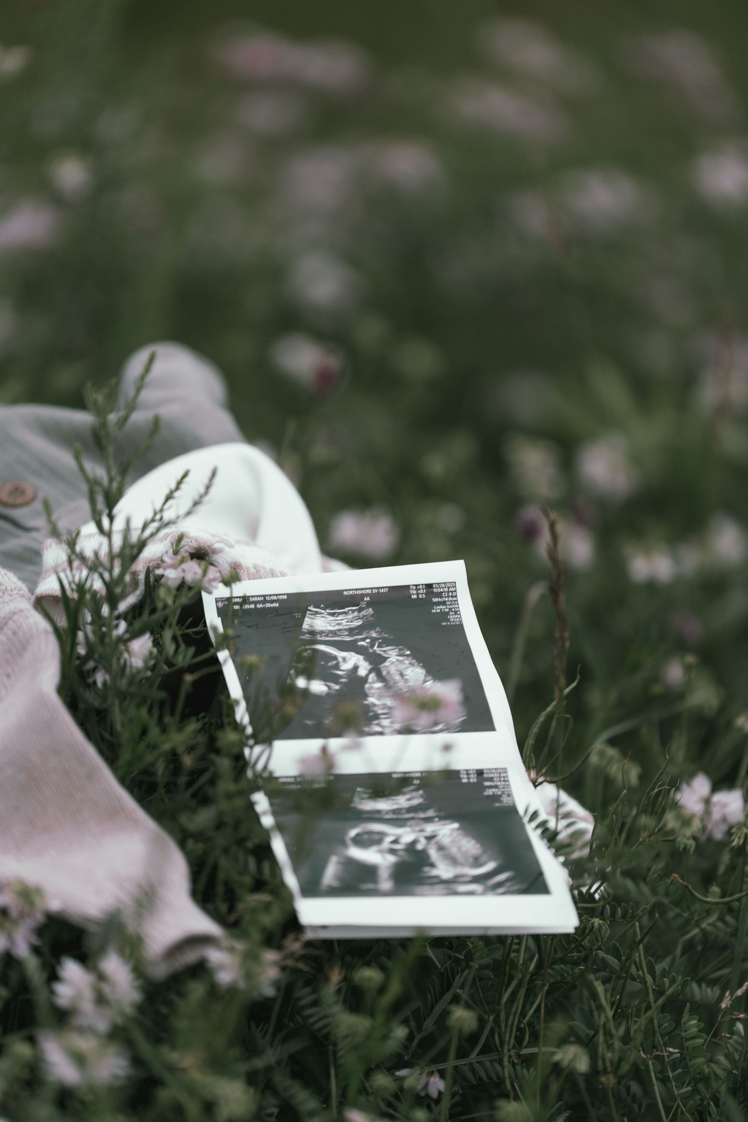 Ultrasound photos resting among wildflowers and baby clothing in a green meadow.