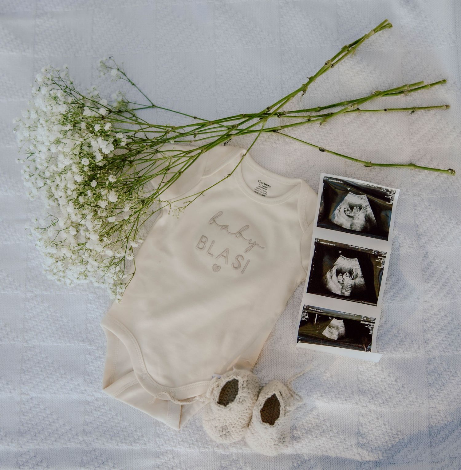 Baby announcement flatlay with onesie, ultrasound photos, booties, and white flowers on white background.