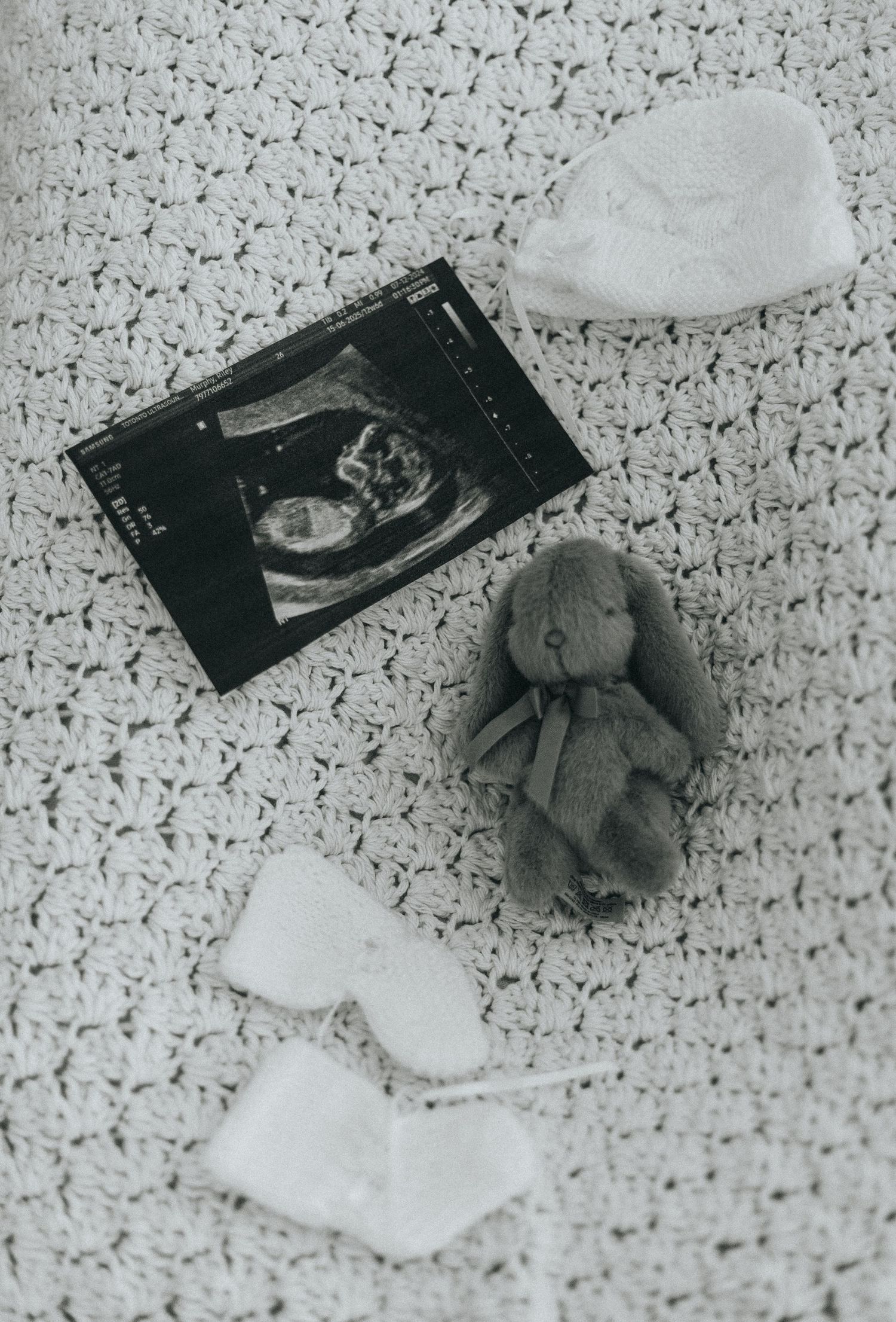 Ultrasound images and baby items arranged on a textured floral background.