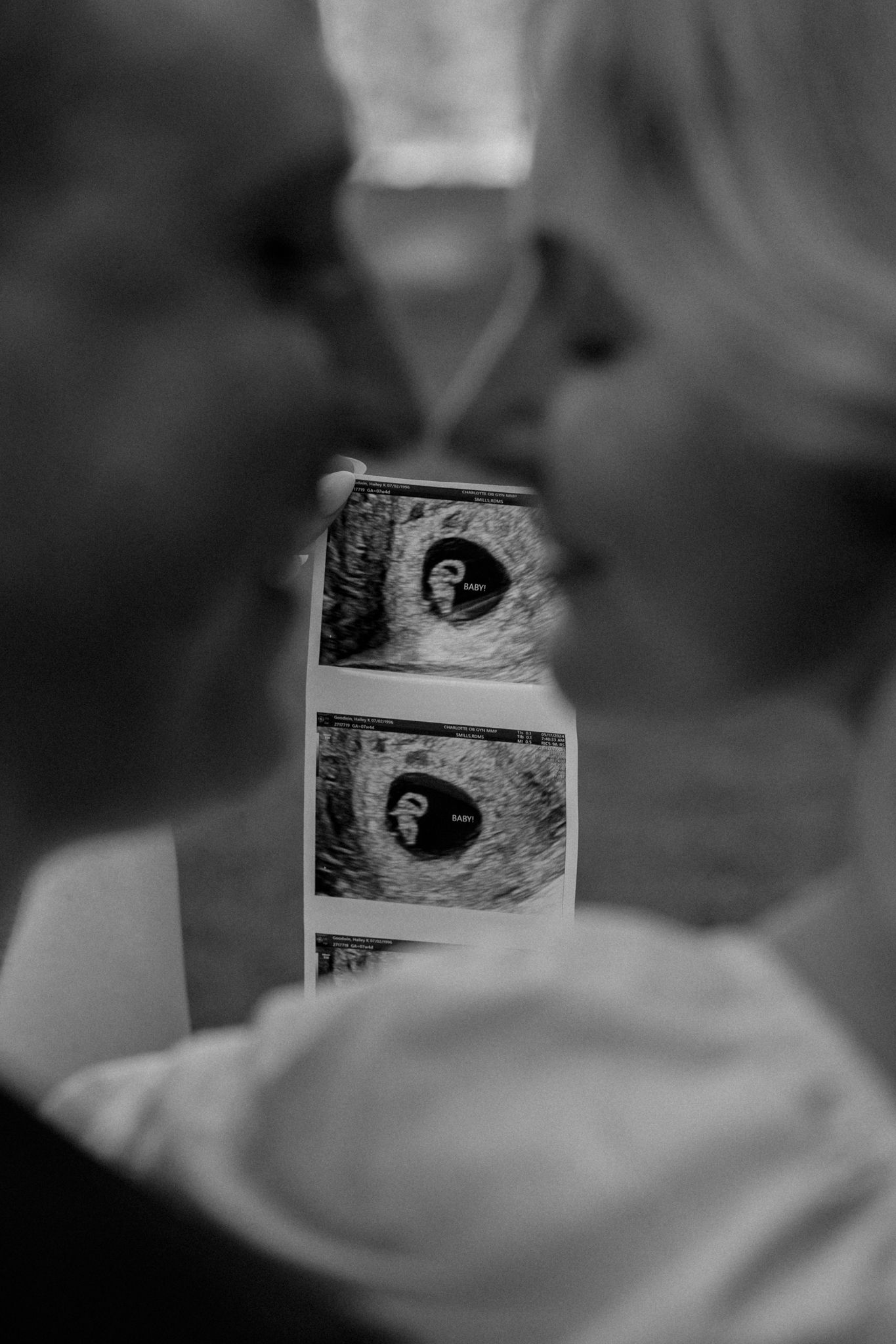 Black and white ultrasound photos held in soft focus with gentle lighting.