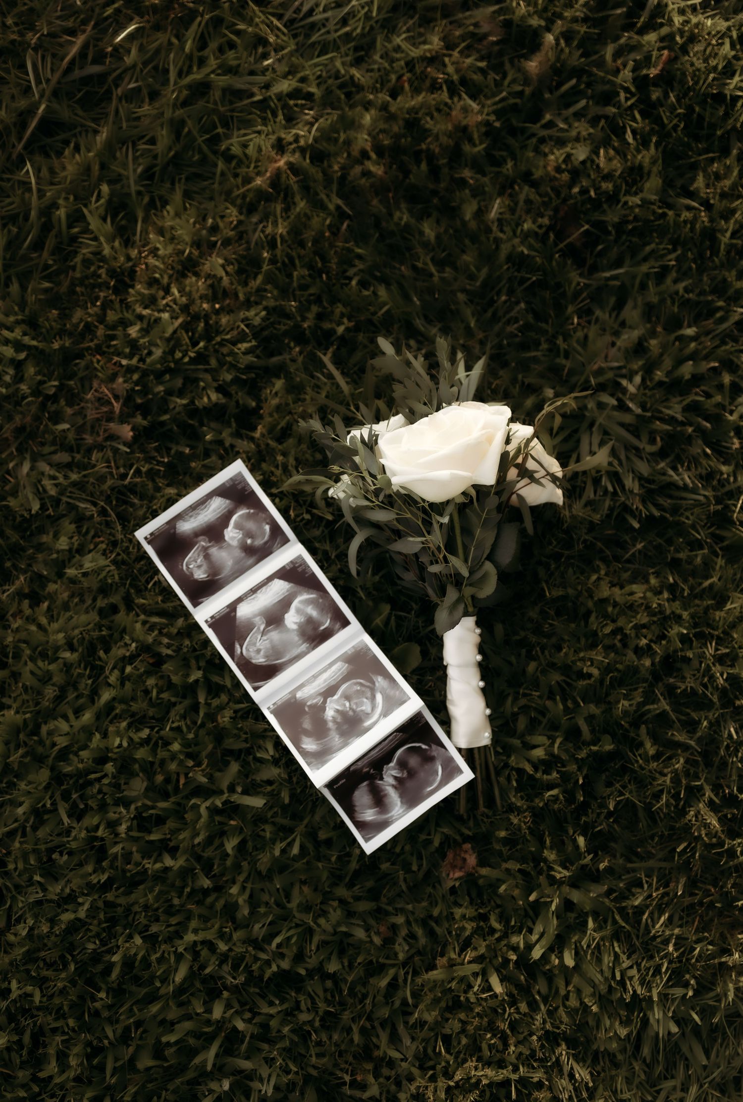 Ultrasound photos and a white rose boutonniere with greenery resting on dark green grass.