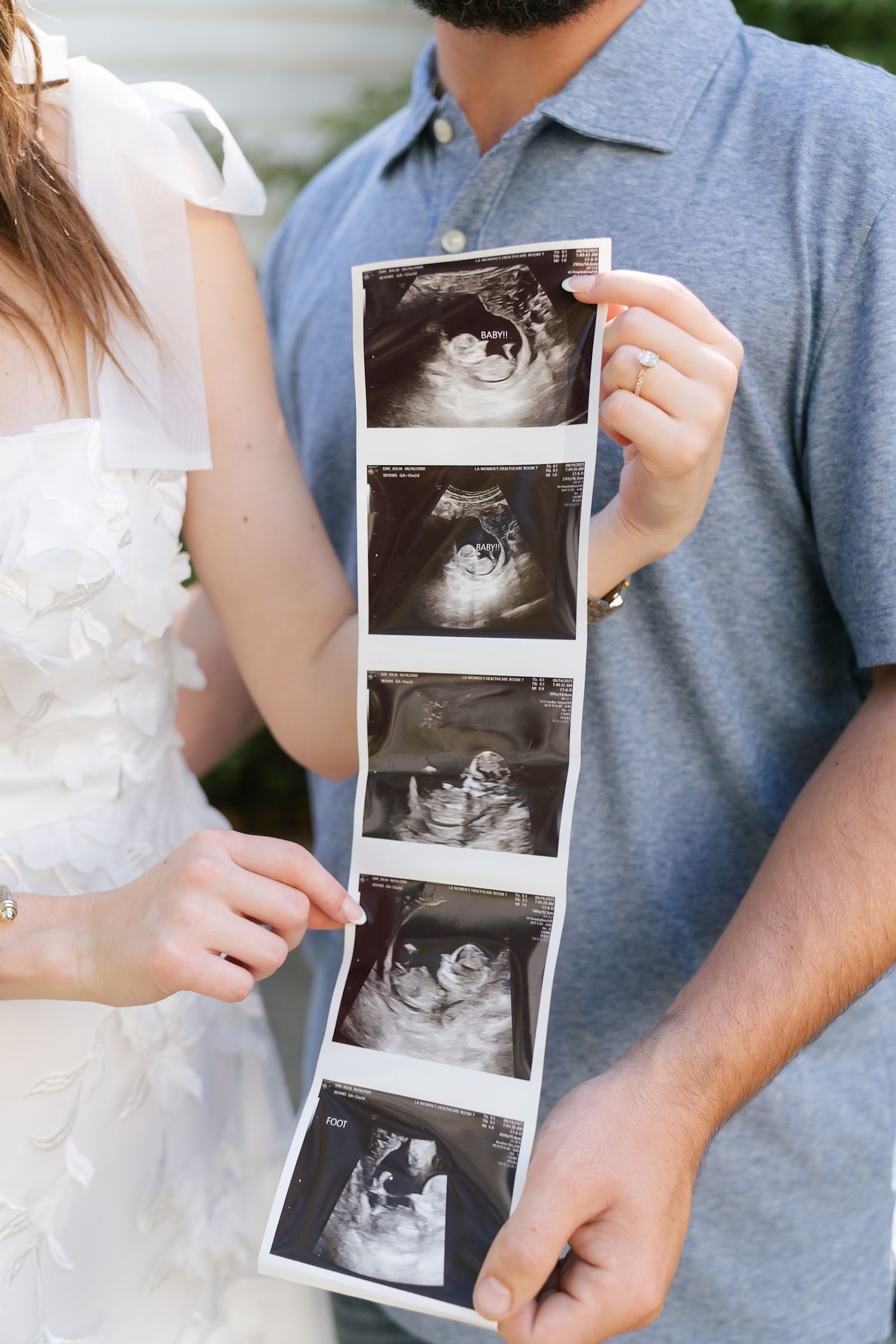 A couple holding ultrasound photos announce their pregnancy with a series of sonogram images.