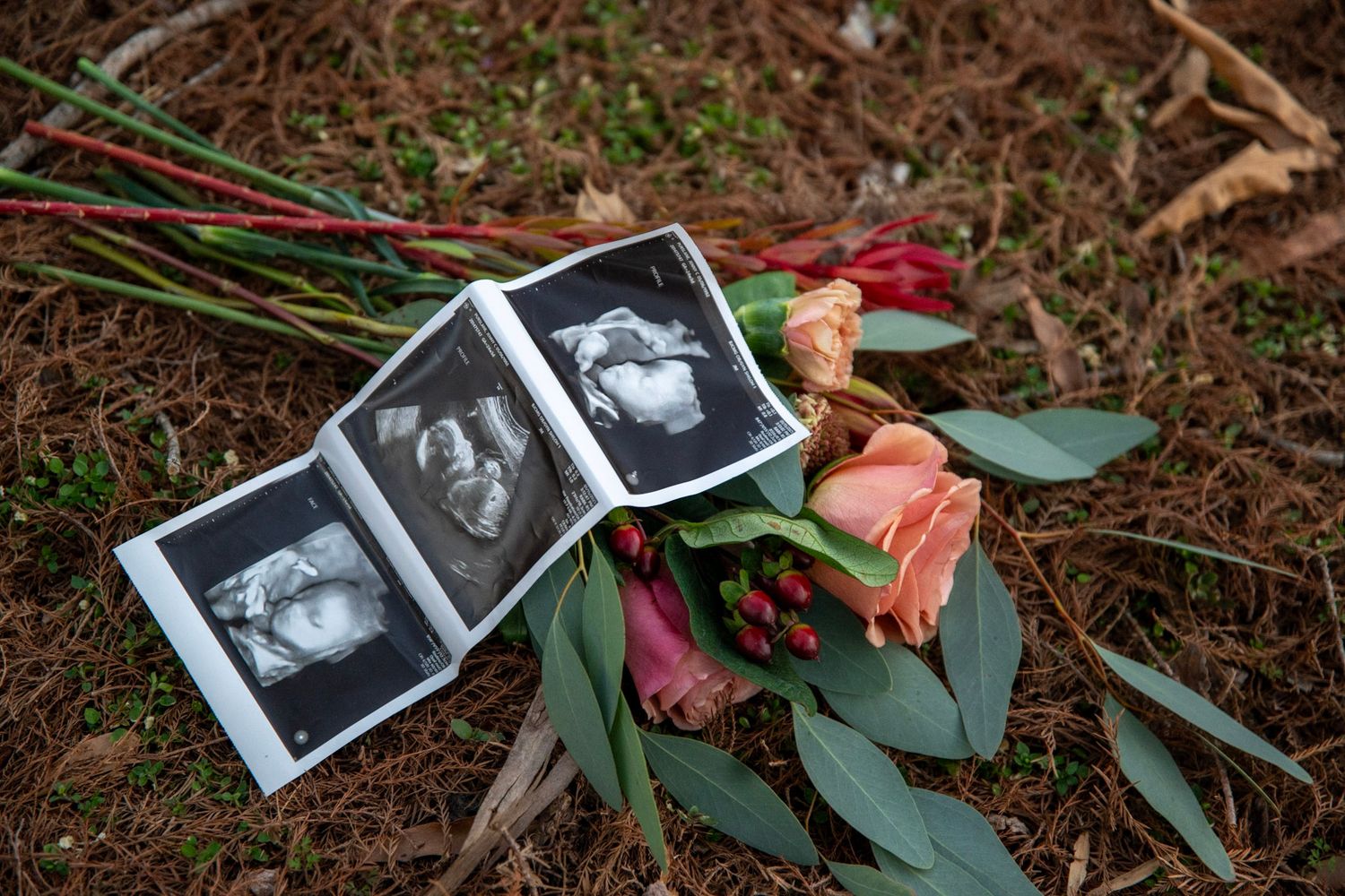 Ultrasound photos laid on forest ground next to pink roses and eucalyptus leaves.