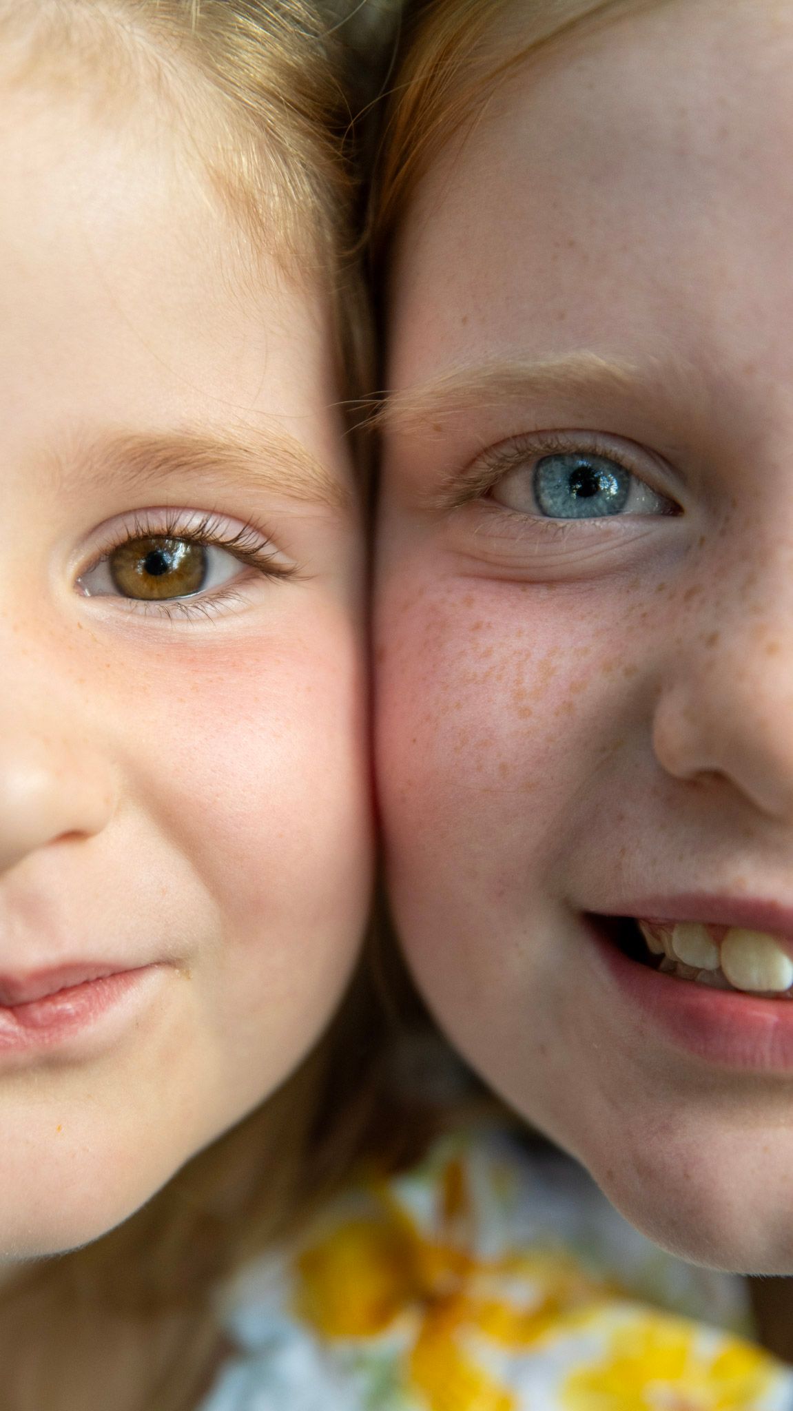 A close-up portrait shows contrasting eye colors and friendly expressions.