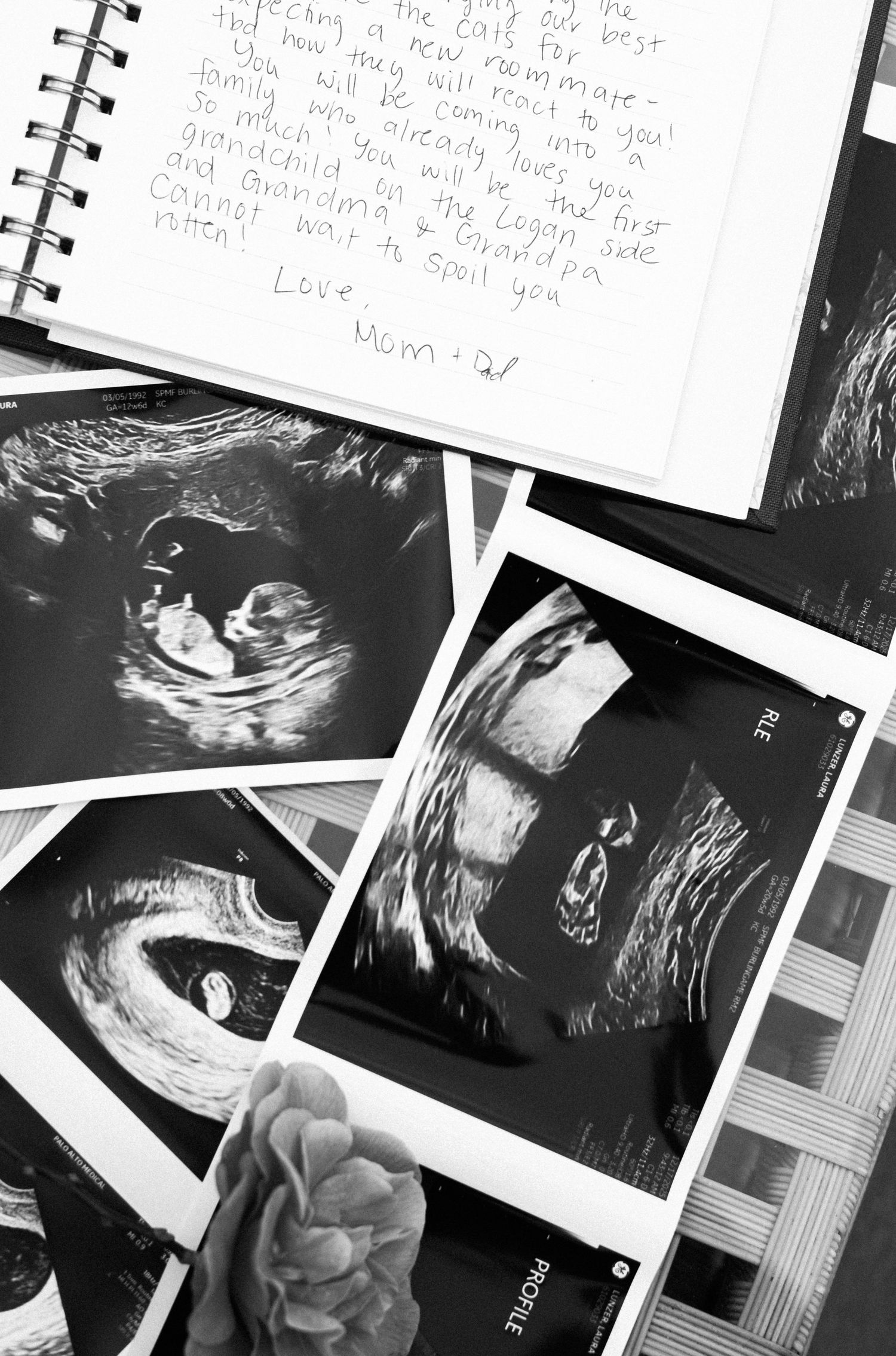 Black and white photo of ultrasound images and a handwritten letter to an unborn grandchild, signed with love.