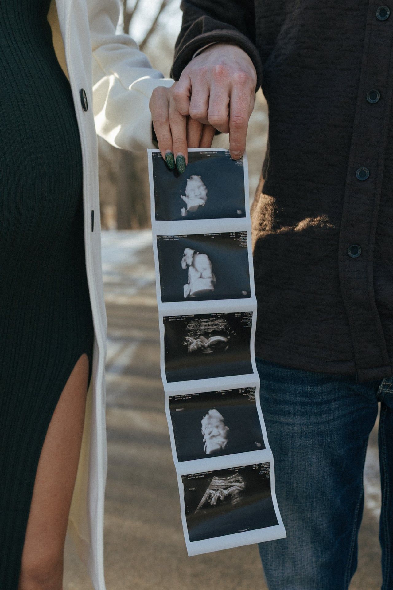 close up of ultrasound for couple