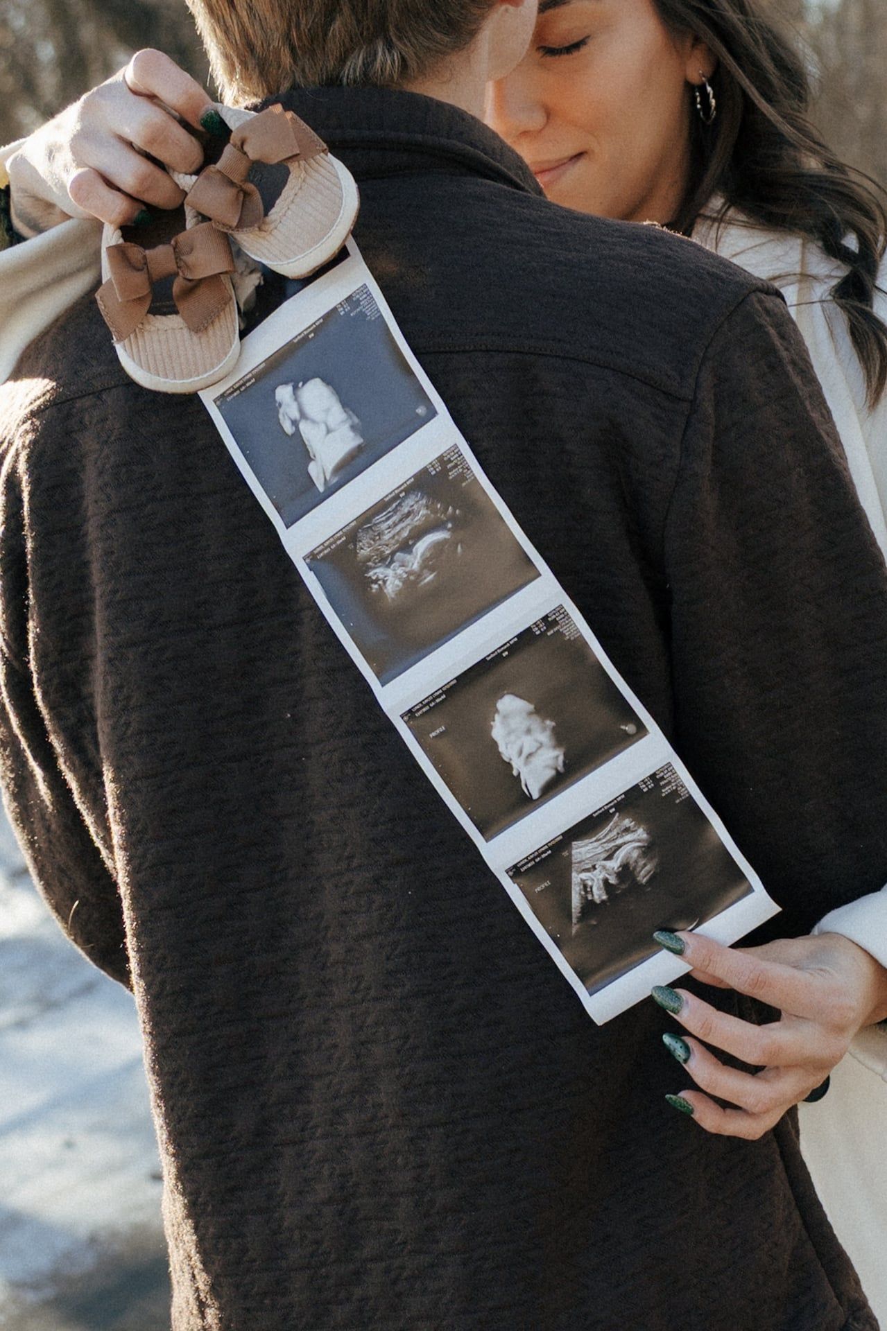 Couple kissing in snowy trees in Bismarck with ultrasound photos