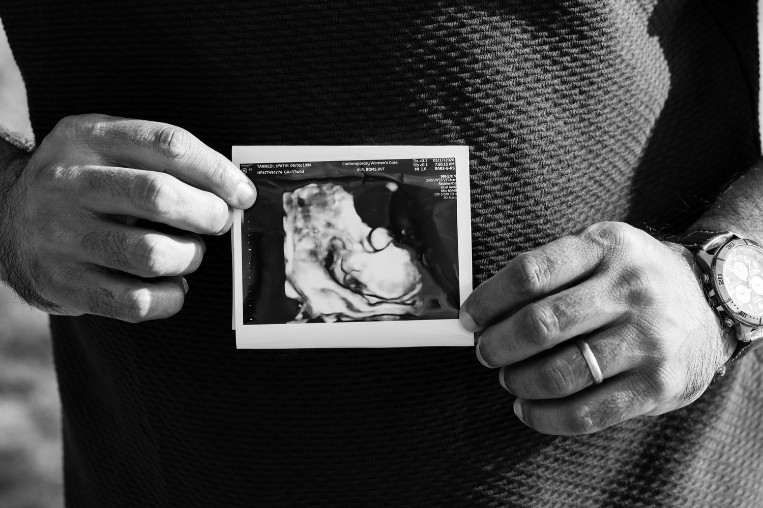Hands holding an ultrasound photo of a baby, with wedding rings visible, in black and white.