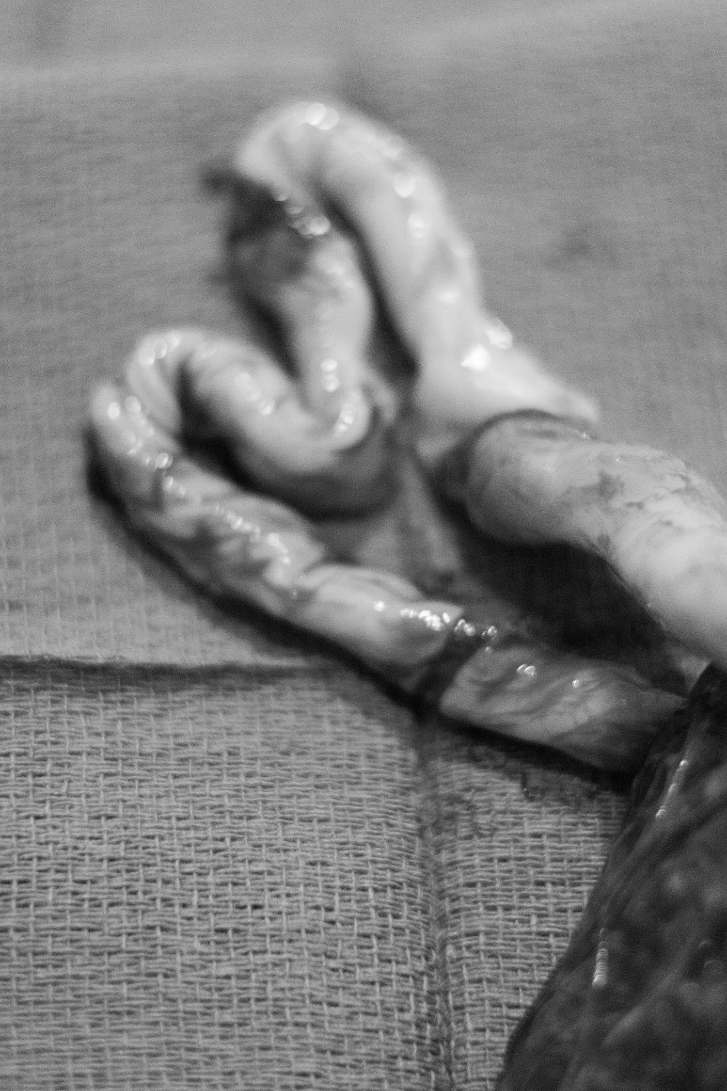 Close-up black and white image of a freshly delivered umbilical cord on a surgical drape.