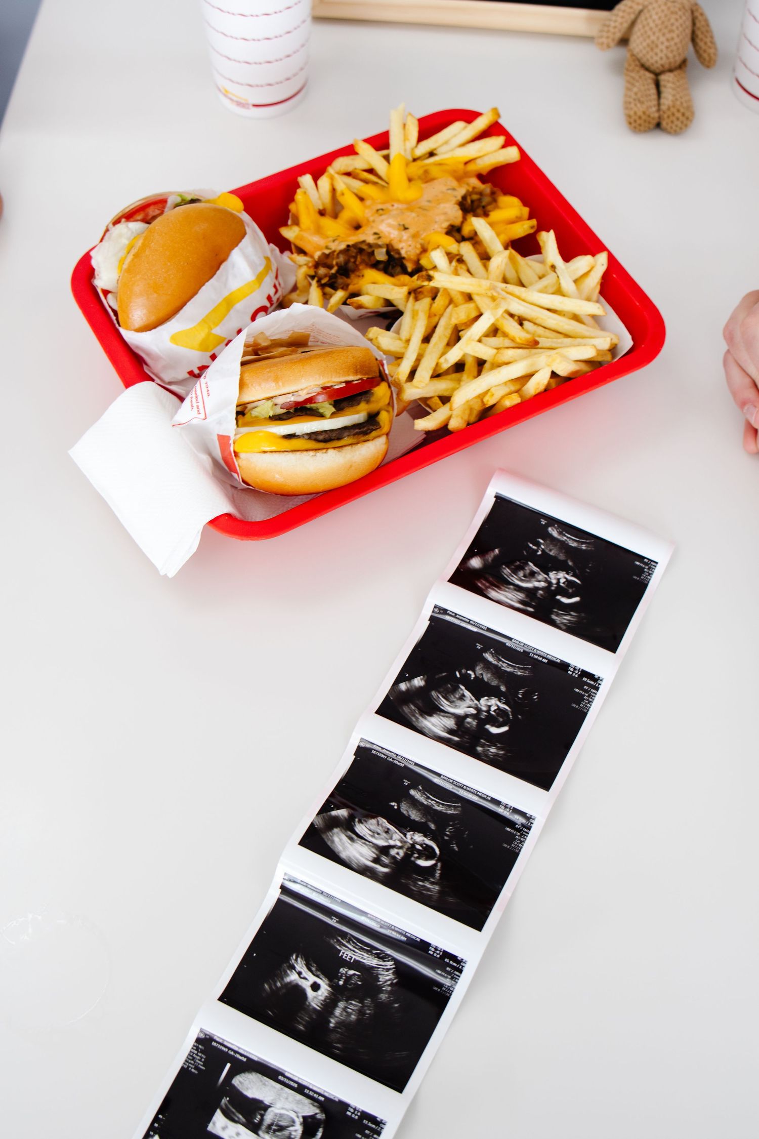 In-N-Out Burger tray with burgers and fries next to a strip of ultrasound photos on a white table.