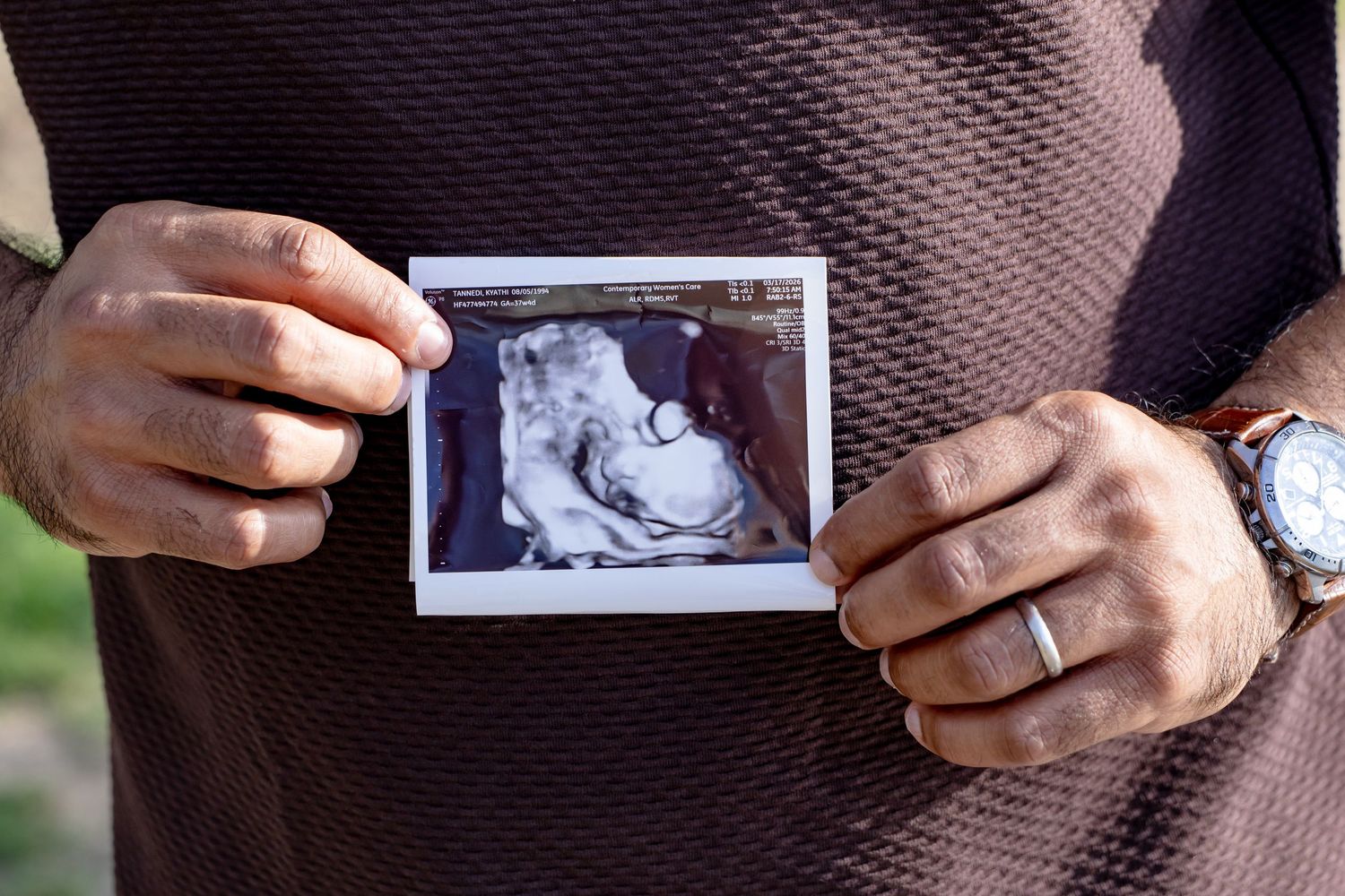 Close-up of expectant father holding a baby ultrasound photo with both hands outdoors.