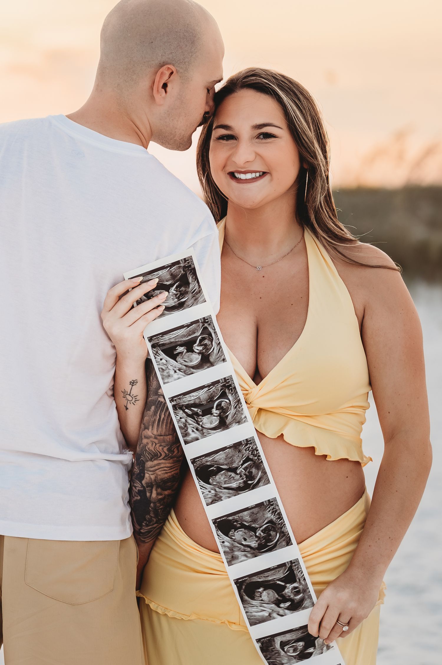 Smiling pregnant woman in yellow holding ultrasound strip with partner kissing her head at sunset beach.