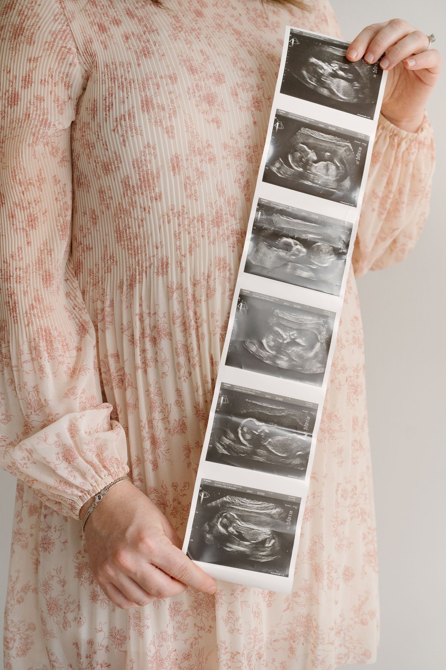 Pregnant woman in floral dress holding a strip of ultrasound photos in front of her baby bump.