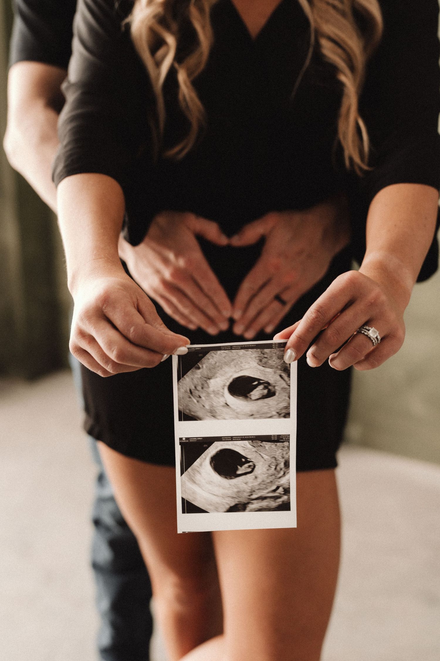 Person in black clothing holds ultrasound photos showing progression of pregnancy in a creative photo series.