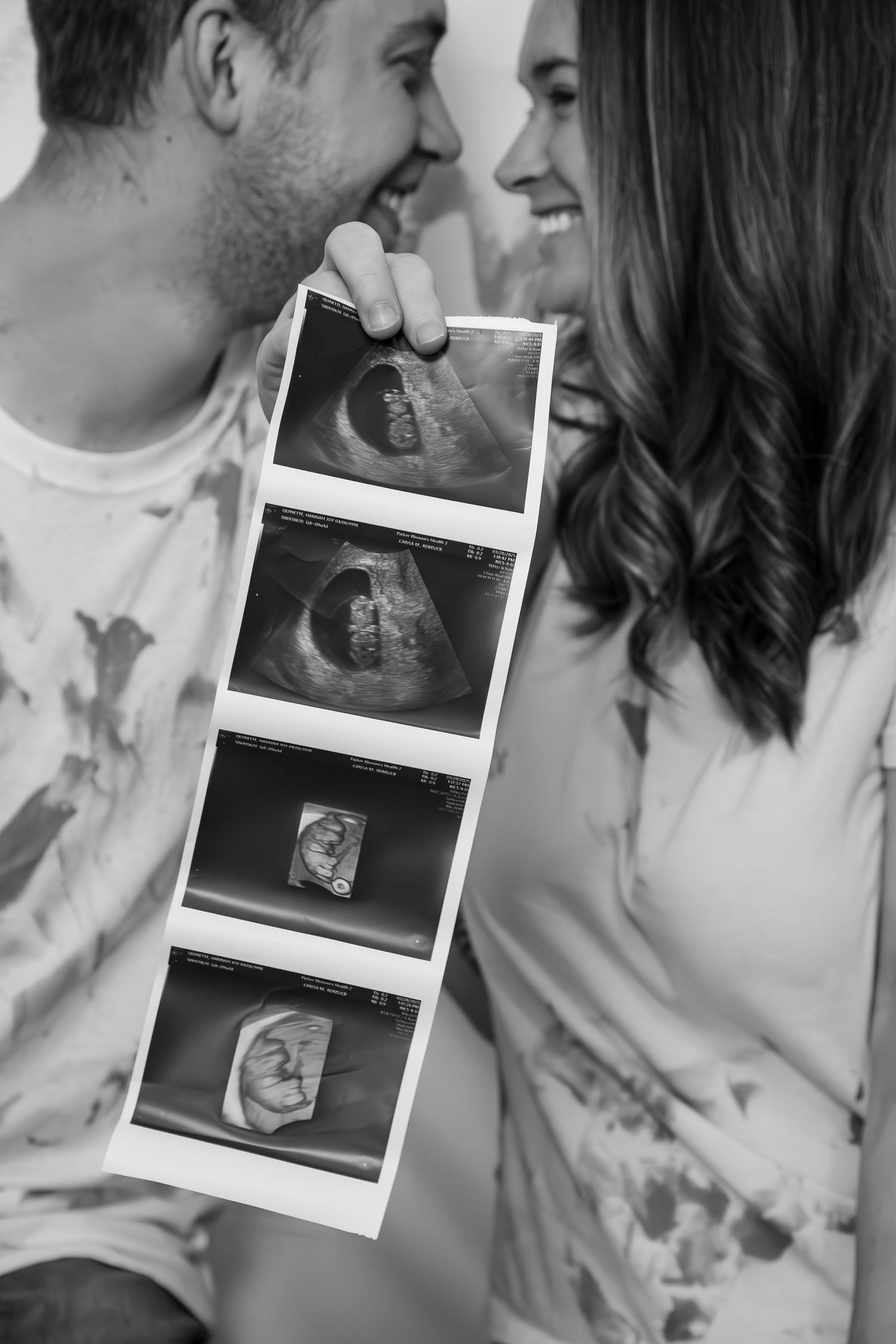 Black and white photographs show an intimate couple's ultrasound pregnancy announcement with photo strips capturing their joy.