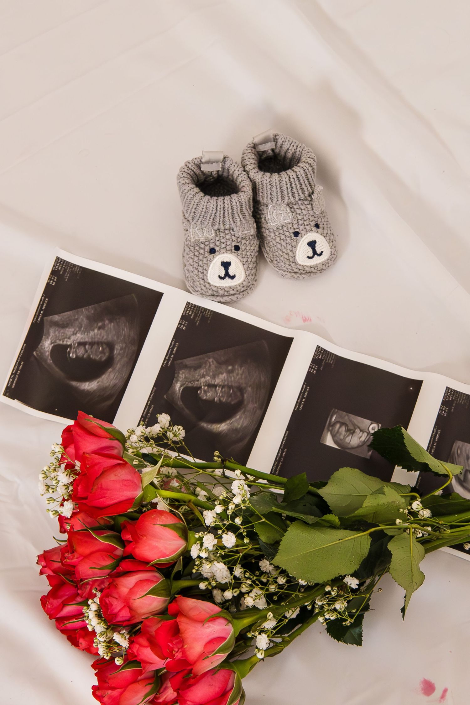 Pregnancy ultrasound photos displayed with tiny knitted baby booties and red roses with baby's breath flowers.