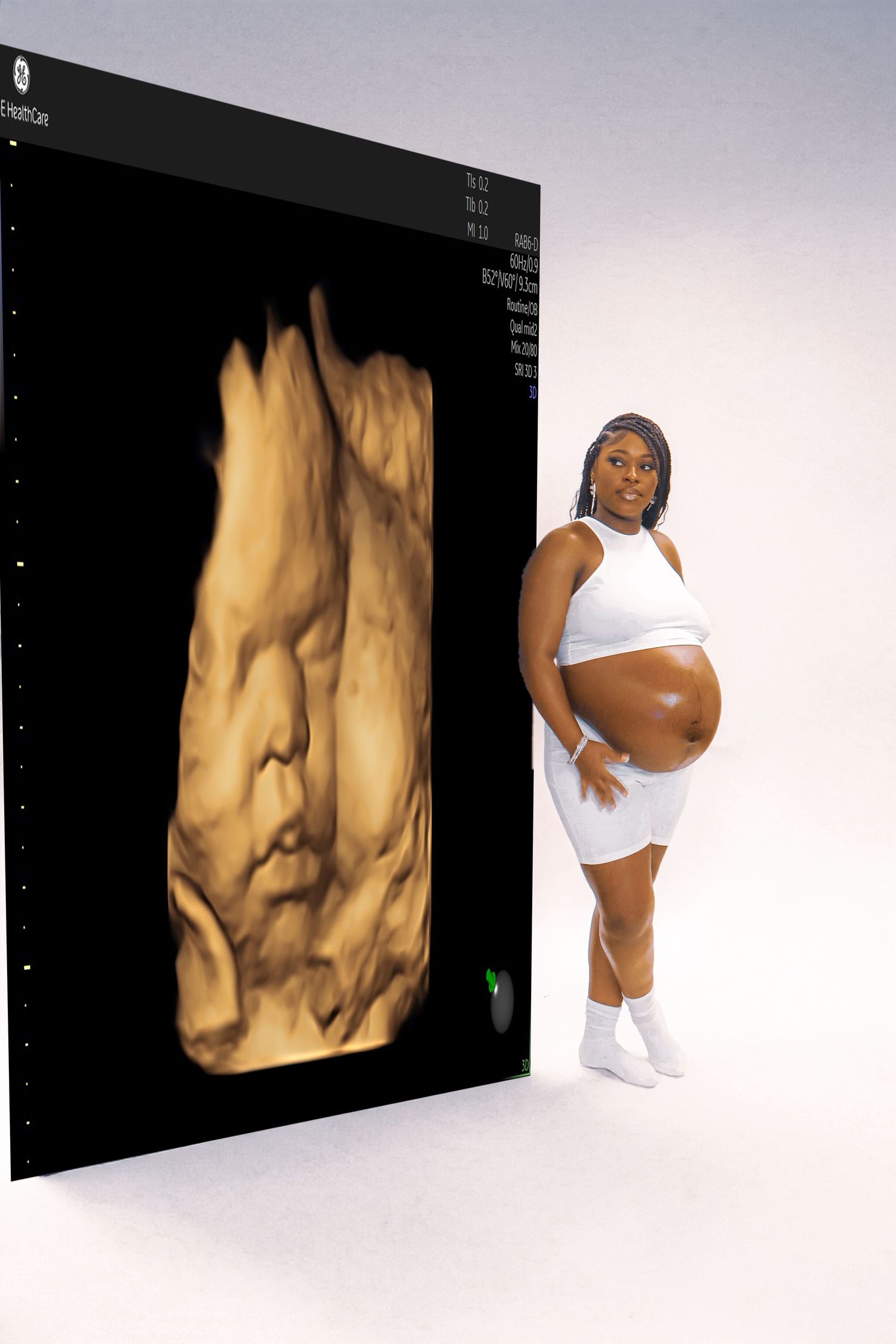 Pregnant woman in white crop top and skirt poses next to large 3D ultrasound scan of her unborn baby.