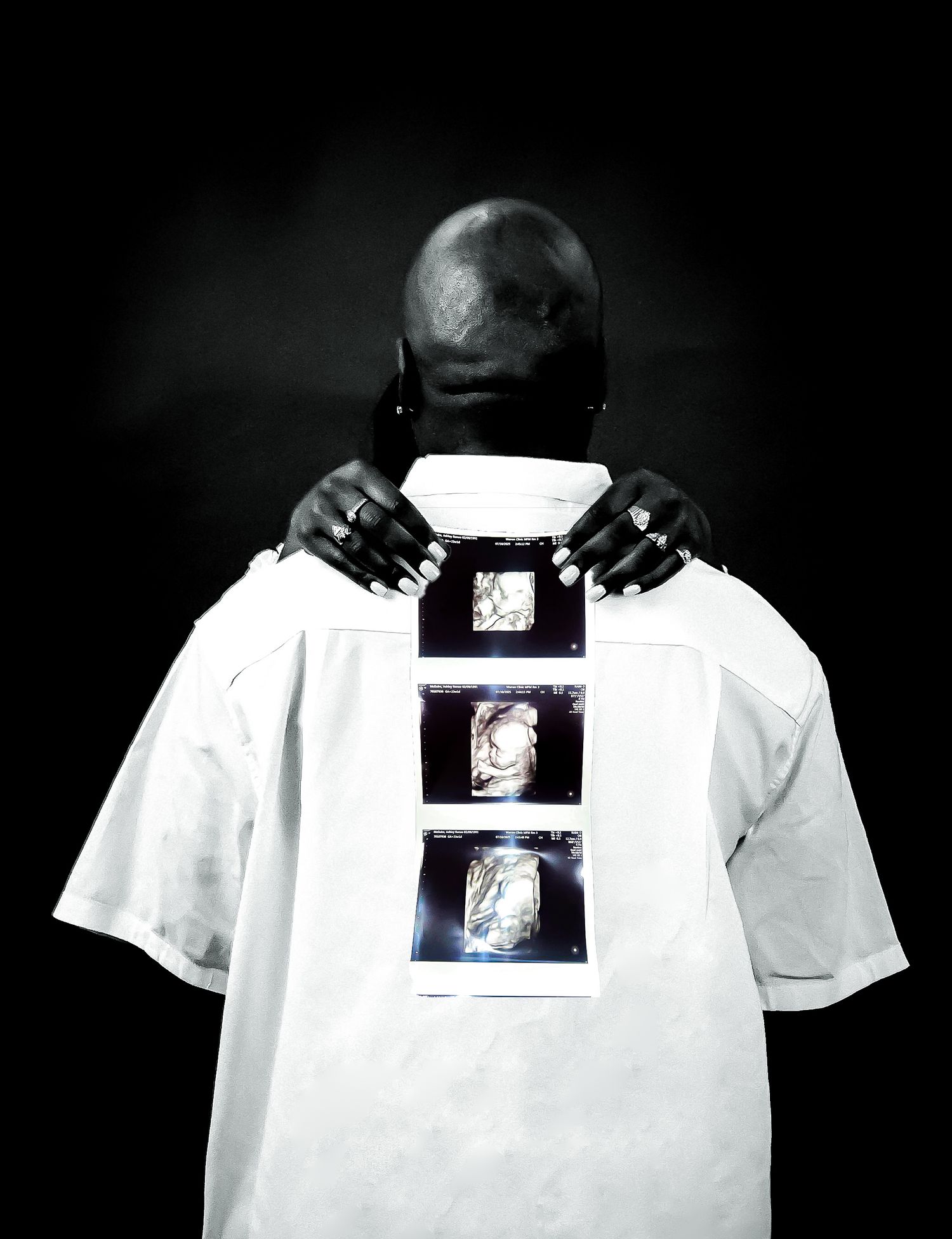 Man in white shirt showing medical X-ray images on his back, viewed from behind in black and white photography.