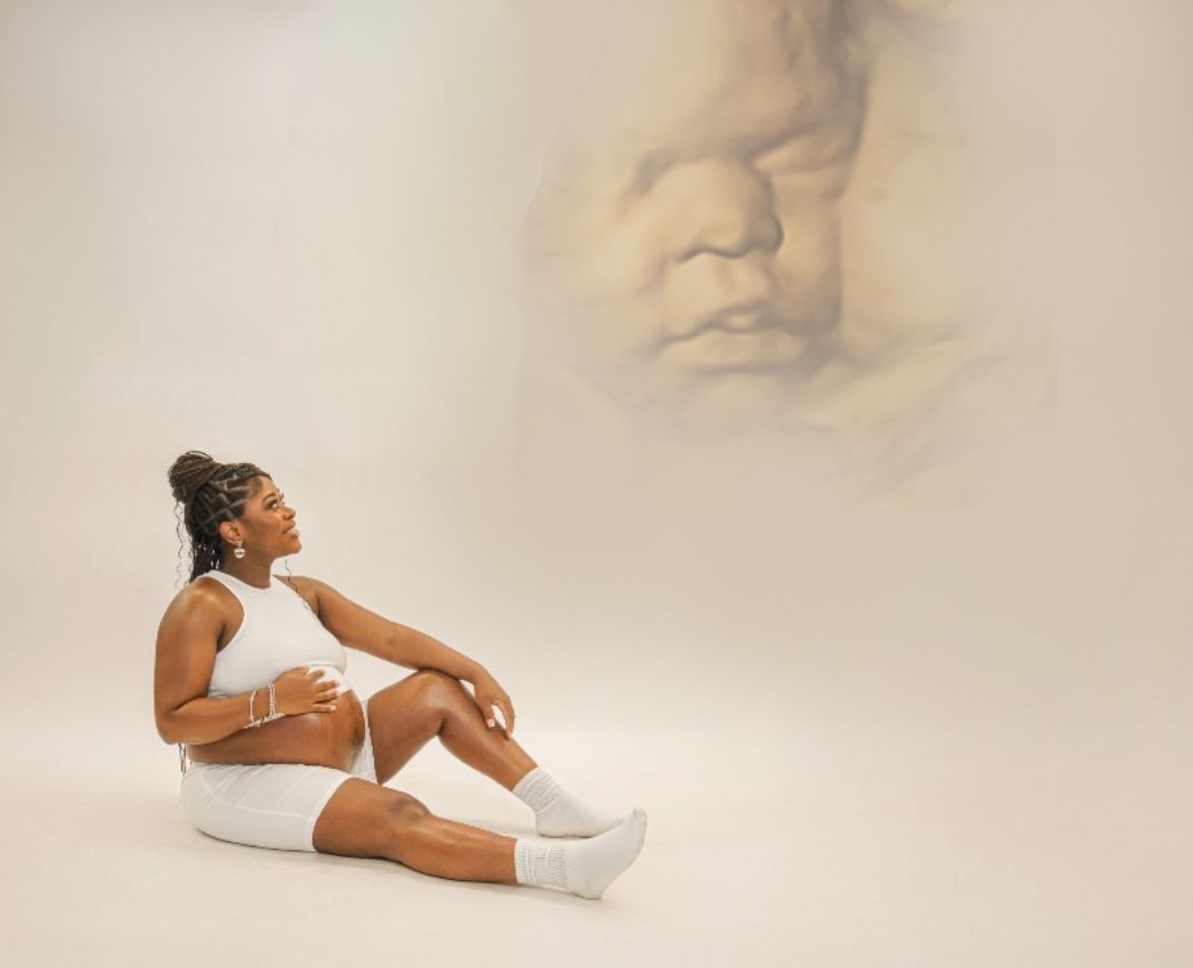Pregnant woman in white outfit sitting beside ultrasound image backdrop.