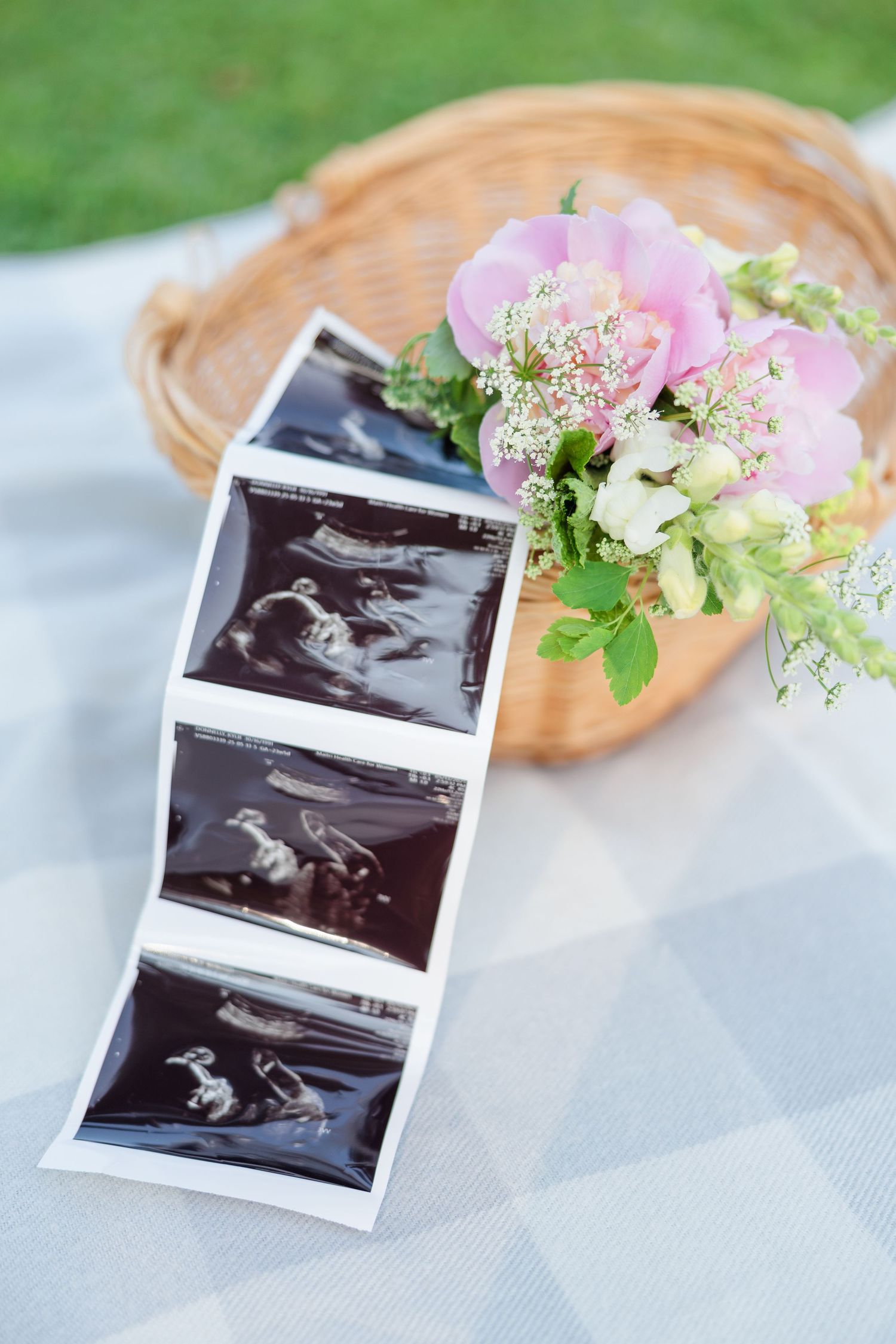 Baby ultrasound photos displayed on a blanket beside a floral bouquet and wicker basket outdoors.
