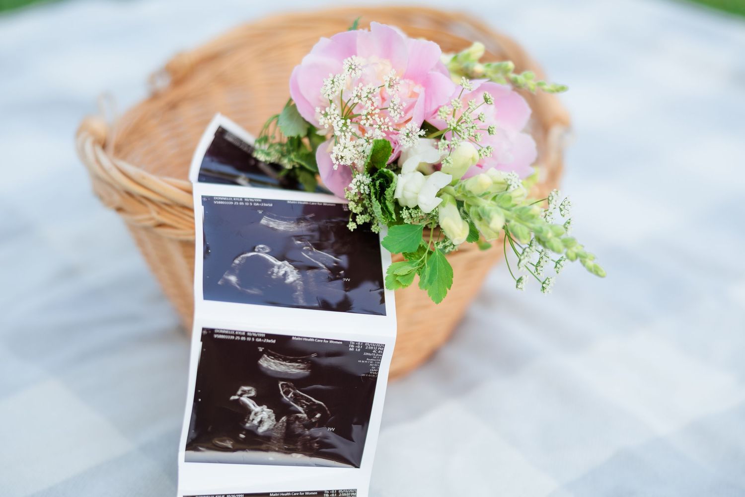 Ultrasound photos and pink peony bouquet in a wicker basket for a maternity announcement.