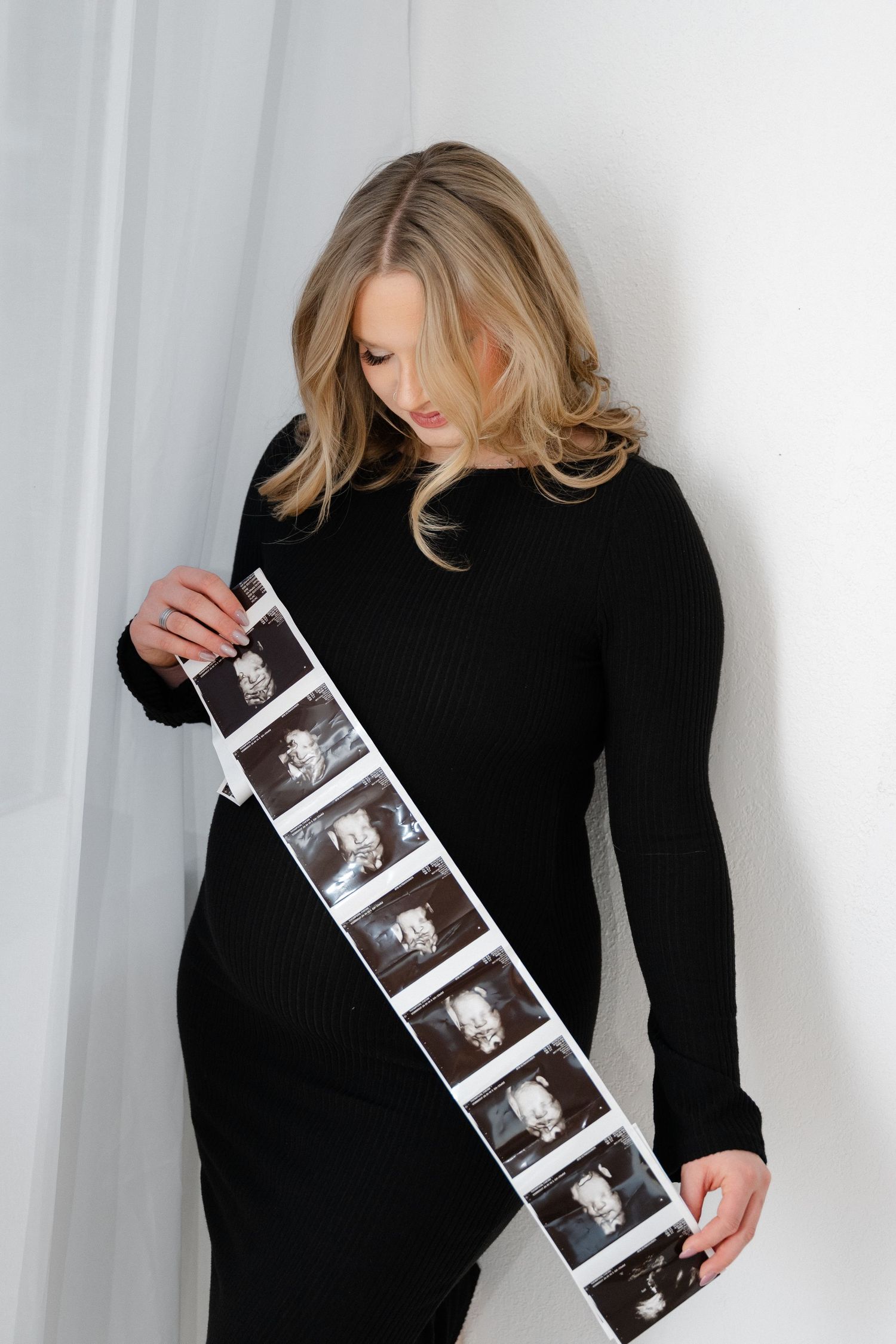 A person in a black sweater holds a strip of ultrasound photos showing the progression of pregnancy.