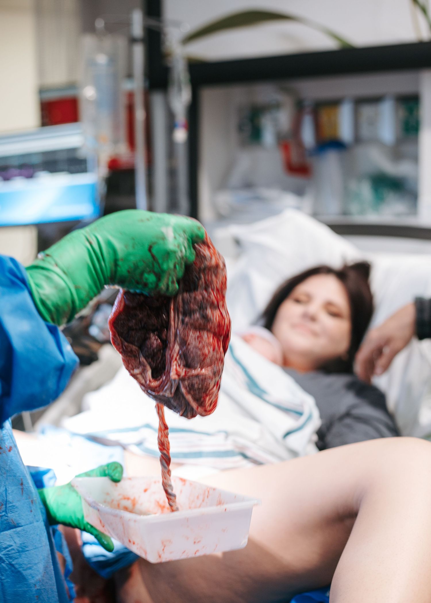 Medical professional handling placenta after delivery in hospital setting.