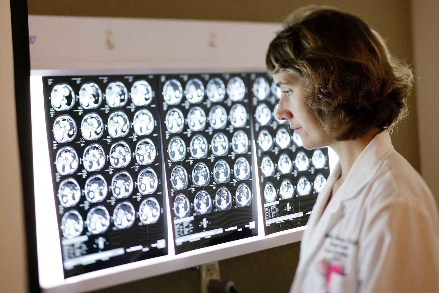 Series of brain scan images displayed on medical light boards for diagnostic review.