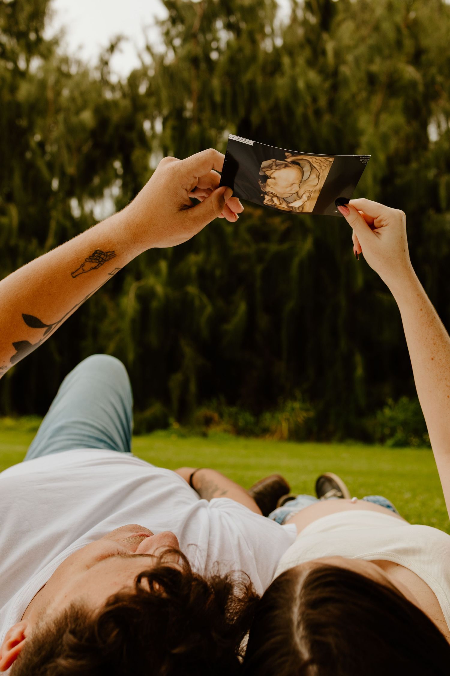 Couple lying on grass holding ultrasound photo above them in outdoor park setting.