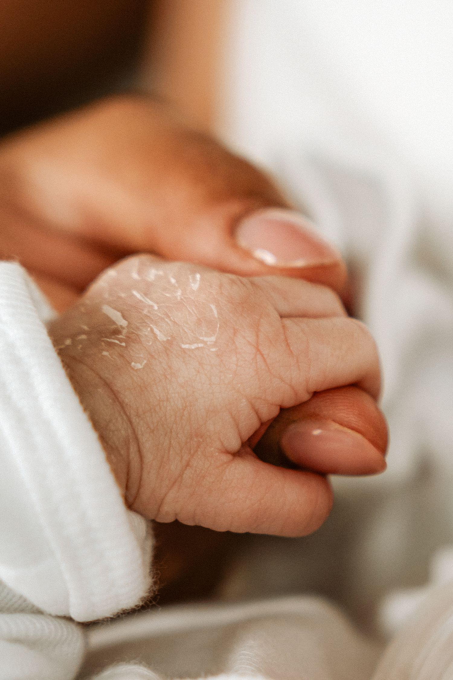 Close-up of a newborn baby's tiny fist with peeling skin held gently by an adult finger.