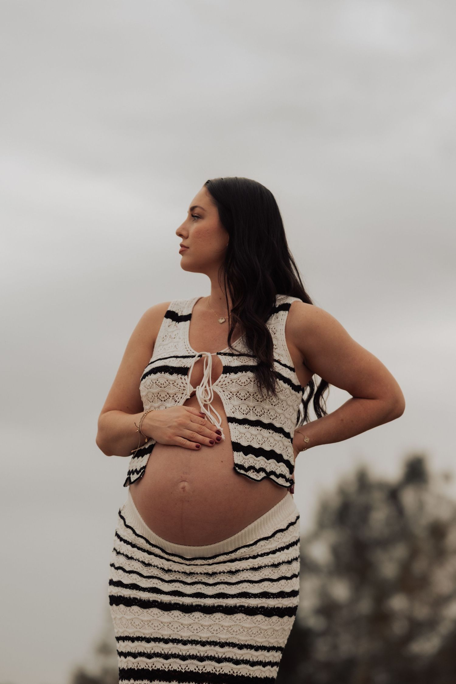 Maternity photos showing a woman in a striped dress posing against an overcast sky.