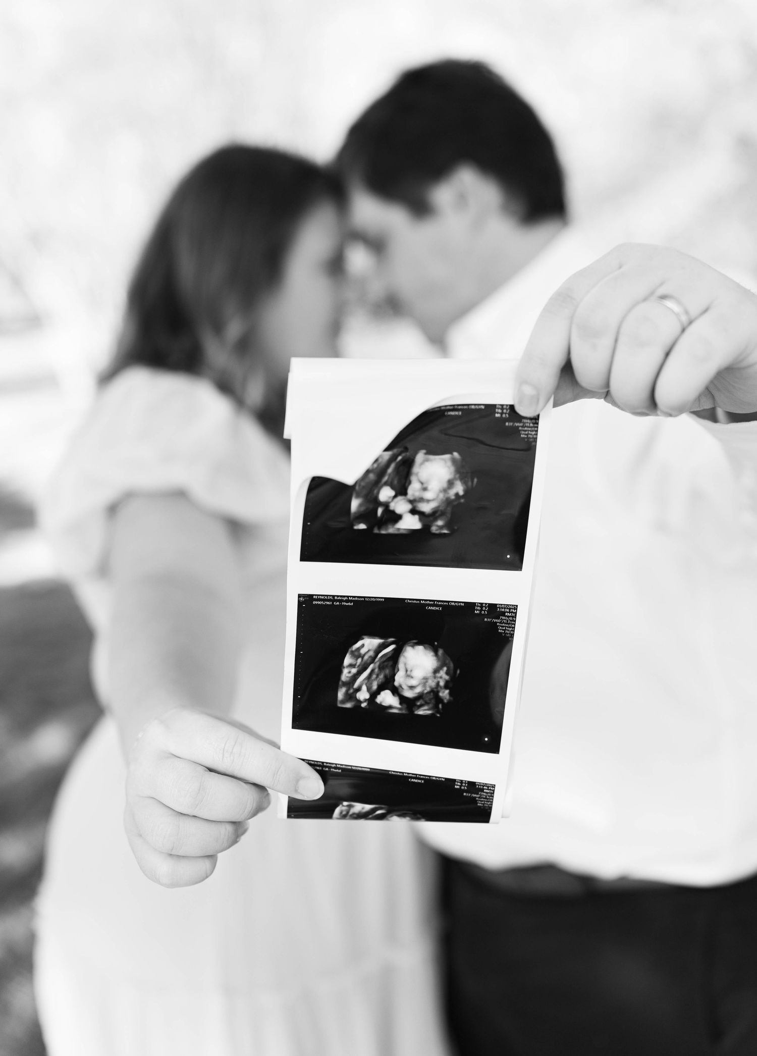 A couple holds an ultrasound photo strip showing their baby's first sonogram images in black and white.