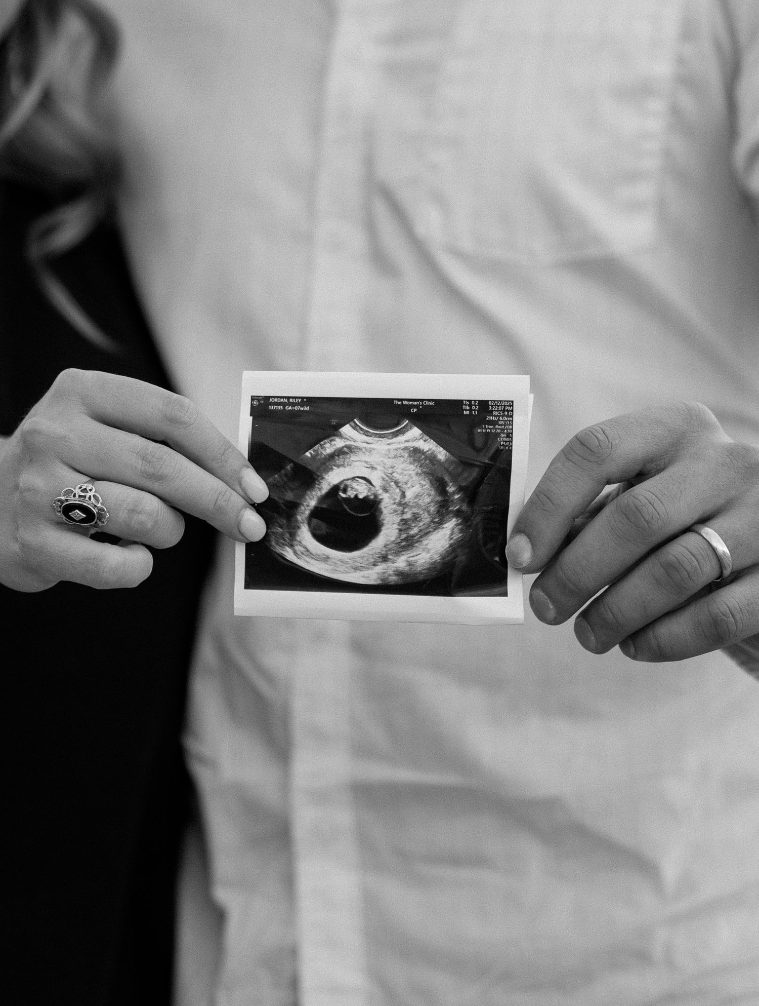 Couple holding a single ultrasound photo together in black and white pregnancy announcement portrait.