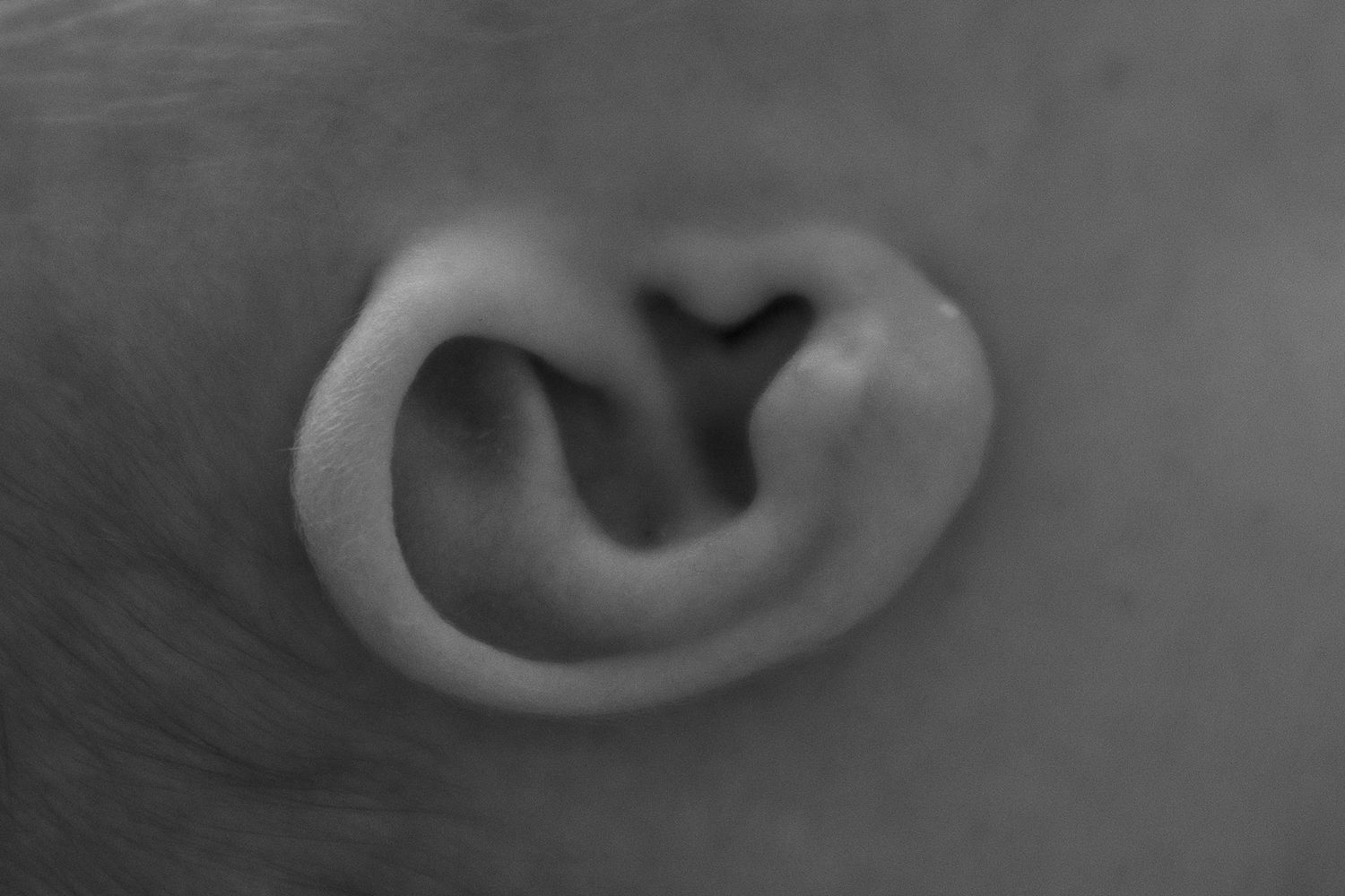A close-up black and white photograph of a human ear showing intricate details.