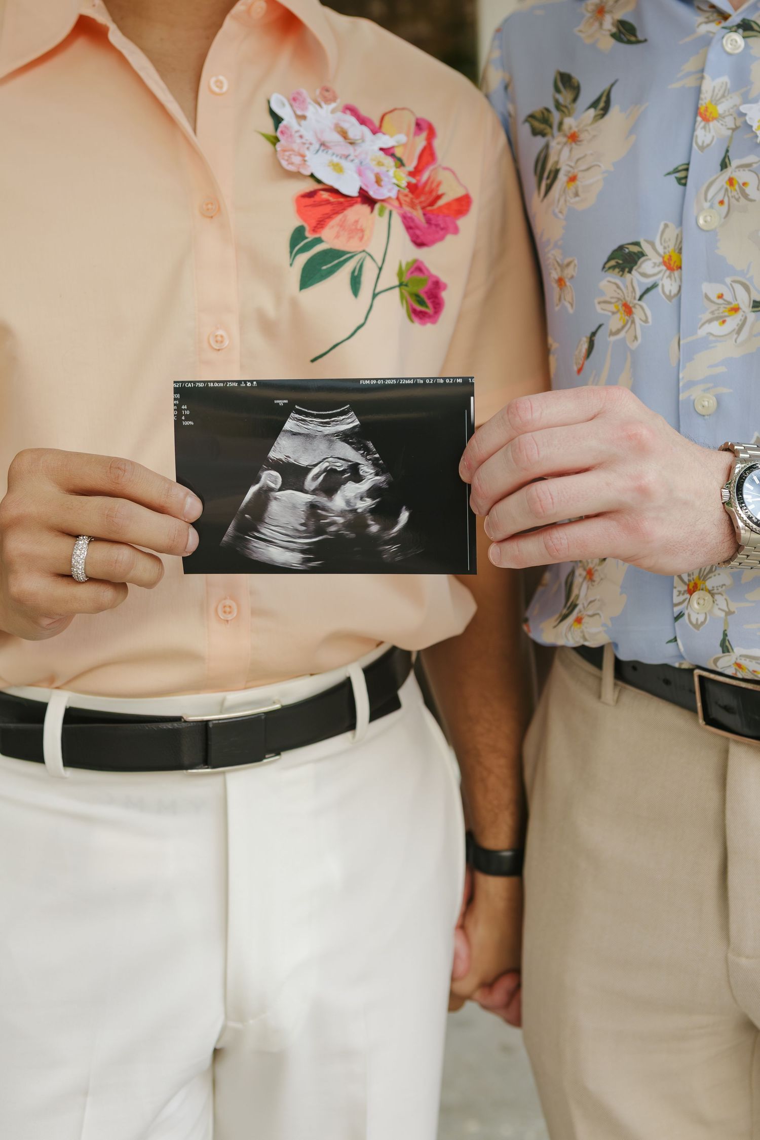 Close-up of same sex couple holding sonogram, NYC family photography by Paula Brearley NYC baby shower photographer