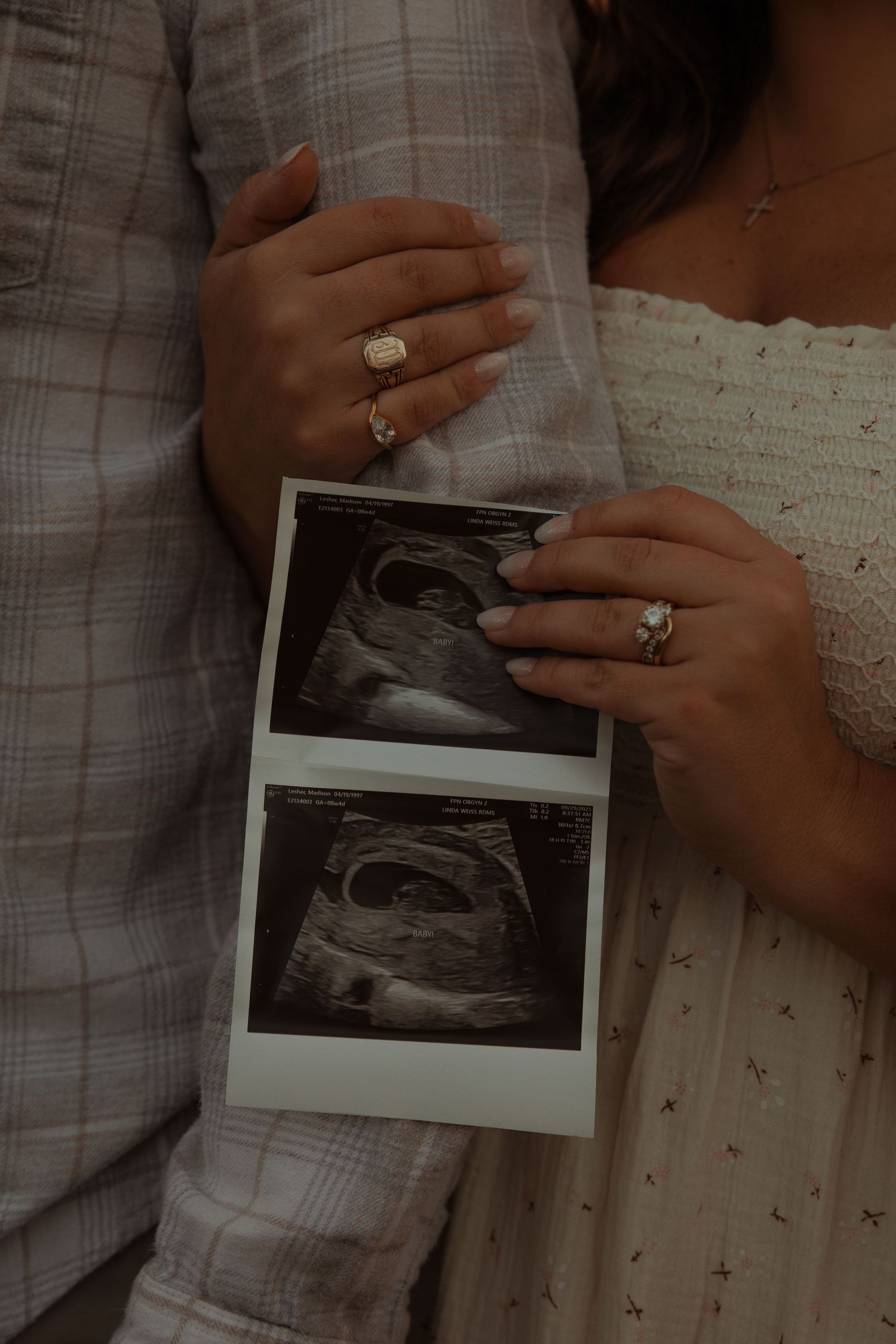 Close-up of couple holding ultrasound scans with engagement rings visible during pregnancy reveal.