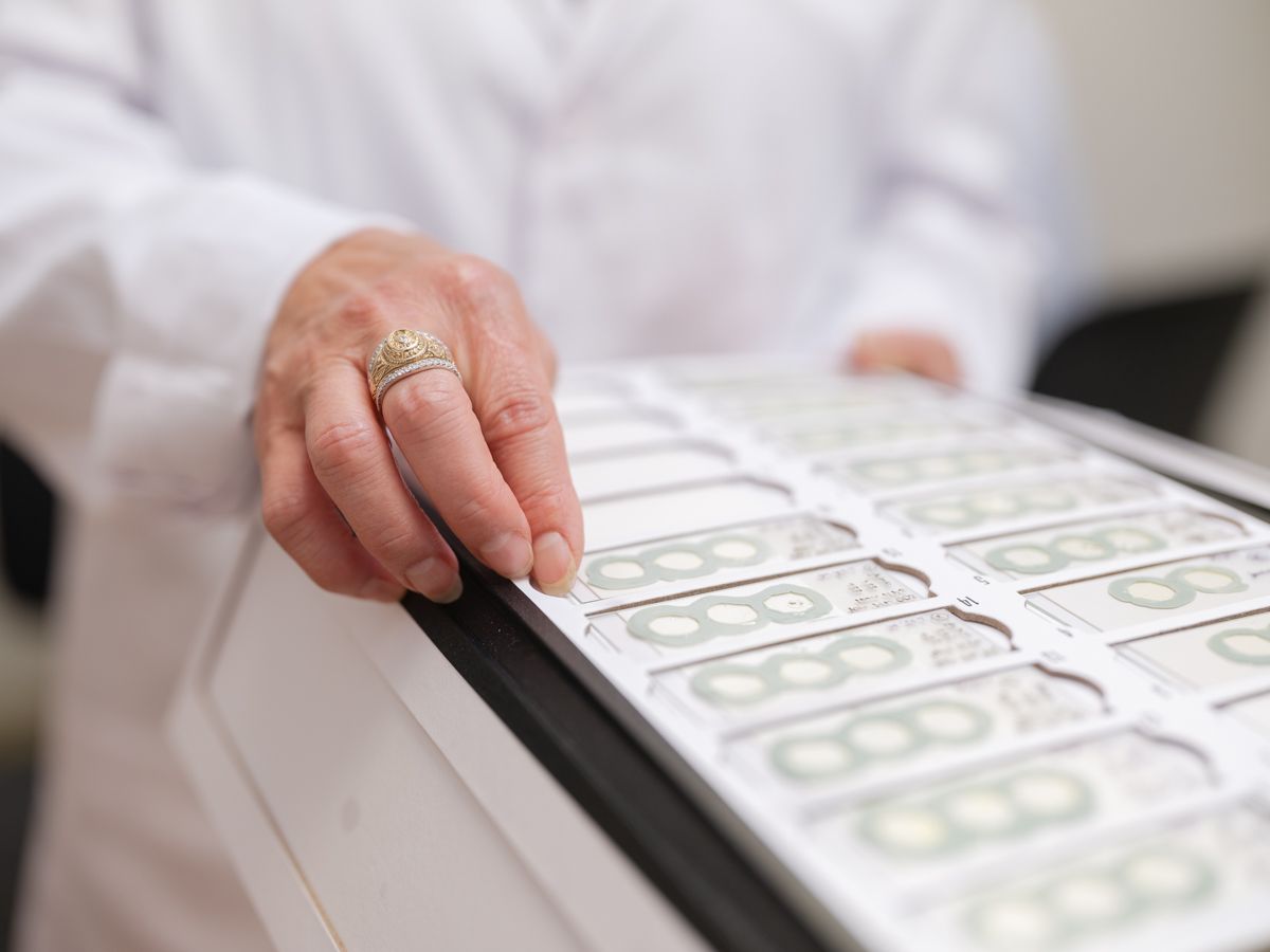 Close-up of researcher in white lab coat examining tray of medical or scientific specimen slides.