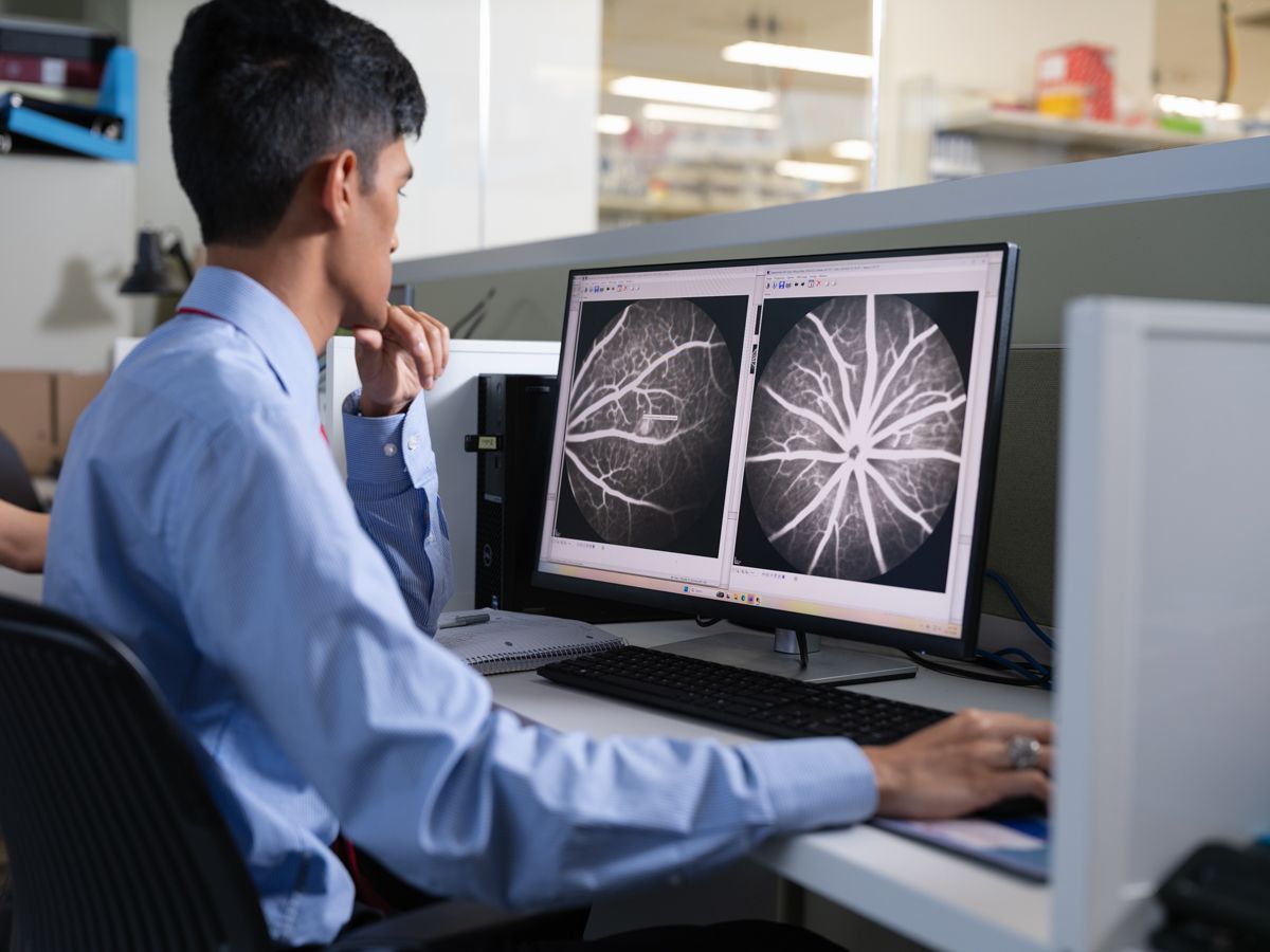 Medical professional analyzing detailed vascular imaging scans on dual computer monitors at desk.