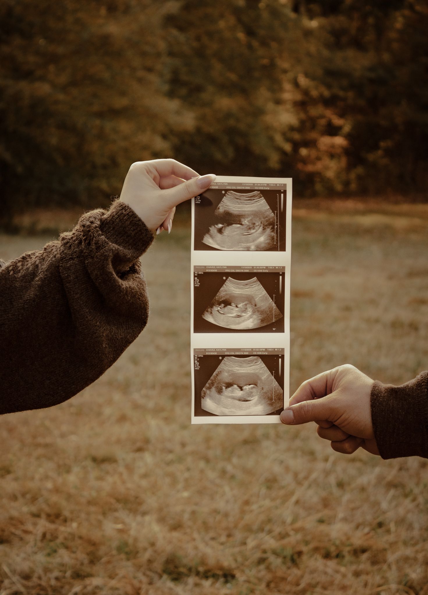 Hands holding ultrasound photos in a sequence outdoors with warm autumn tones in the background.